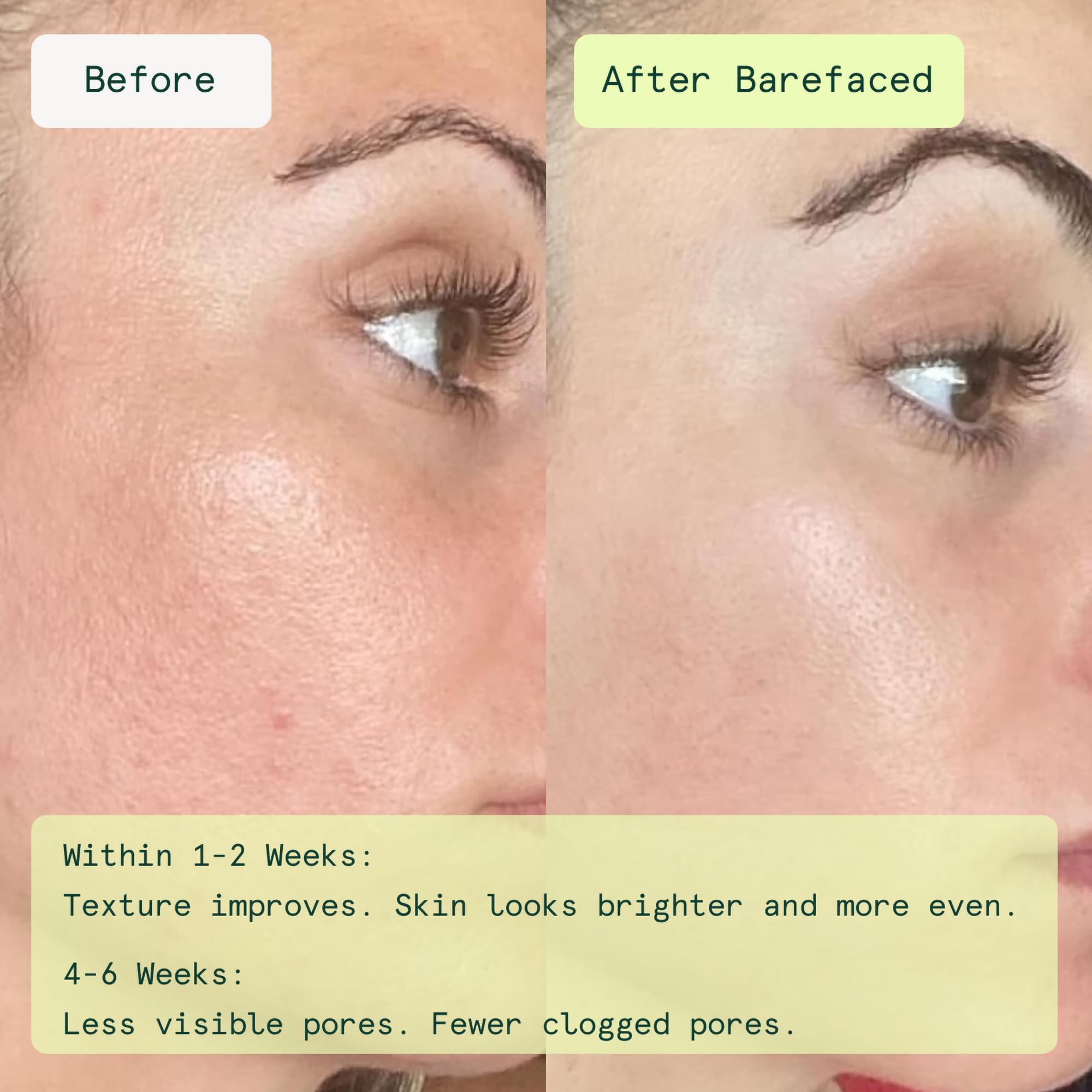 Barefaced Toning and Exfoliating Pads - Barefaced Official Imagery - 3