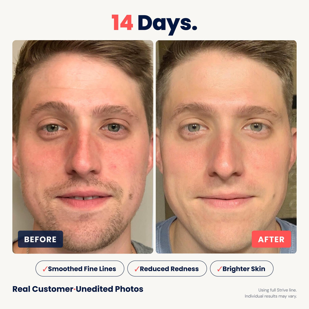 Strive Mens Face Moisturizer for Dark Circles Brightening - Strive Official Imagery - 7