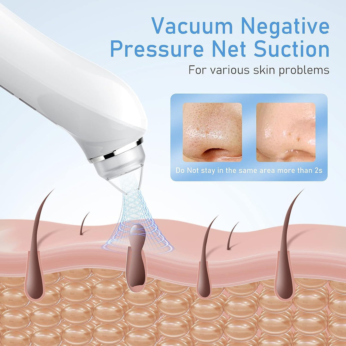 Blackhead Remover Vacuum USB Interface Type Pore Vacuum - Ottleba Official Imagery - 4