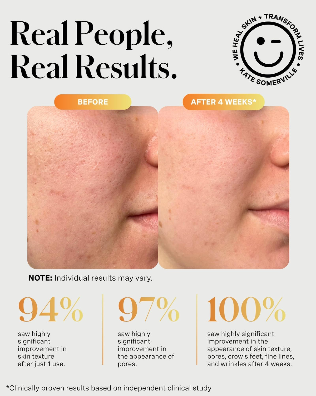 Kate Somerville ExfoliKate Intensive Exfoliating Treatment 0 - Premium Selection Official Imagery - 7