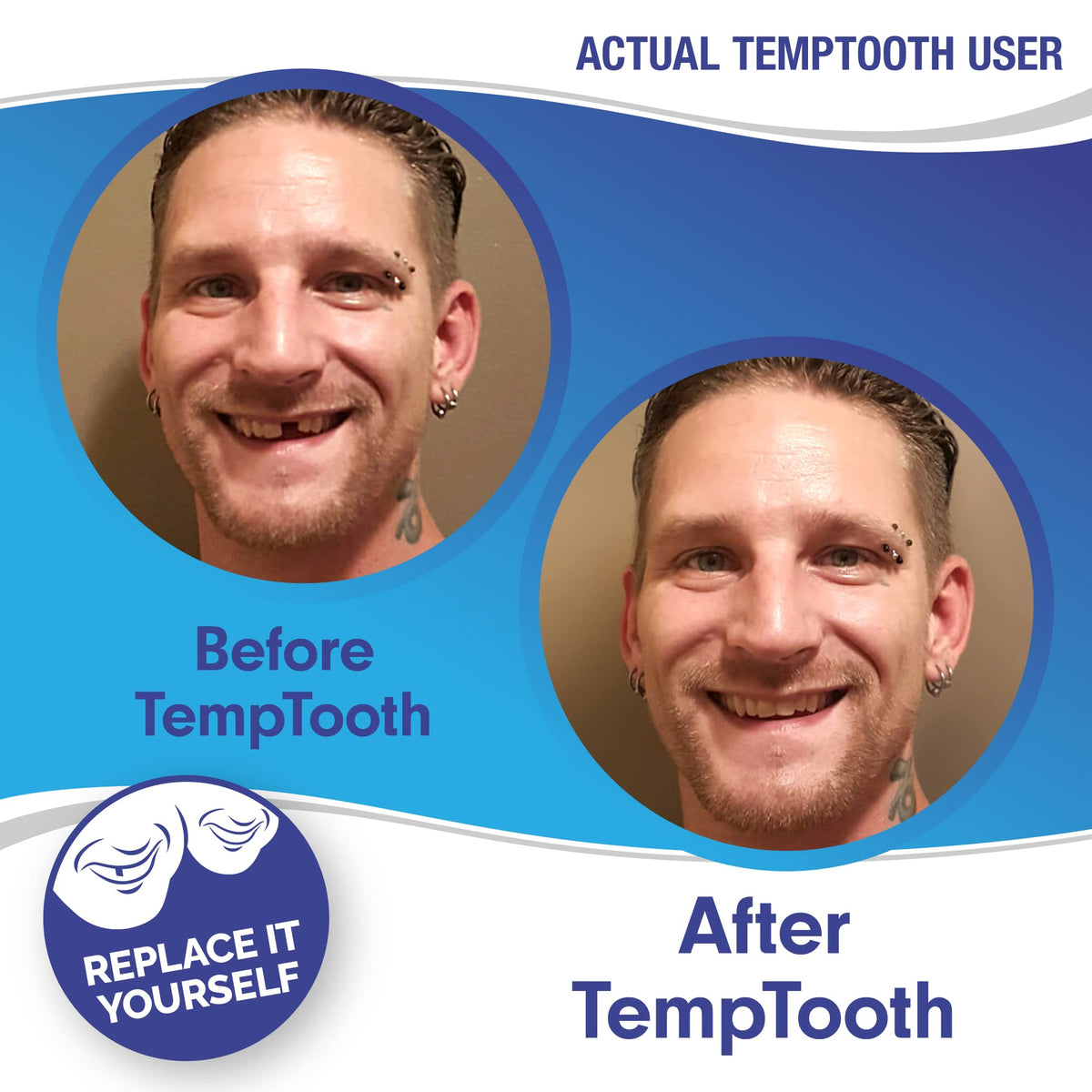 1 Seller Trusted Patented Temporary Tooth Replacement - Temptooth Official Imagery - 5