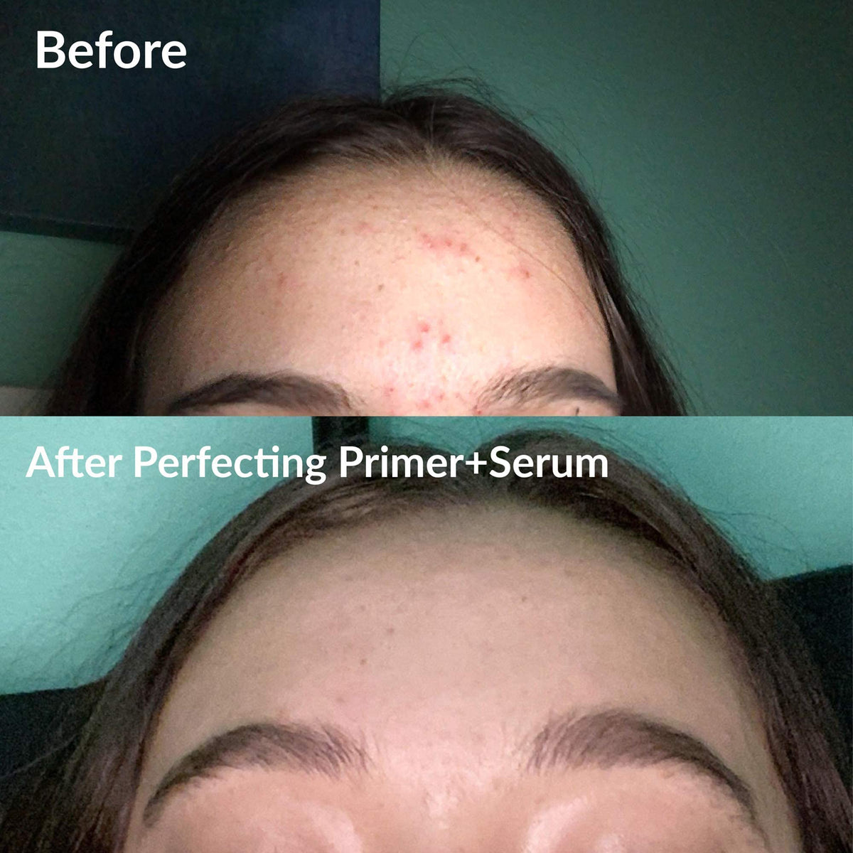 Clear Skin Kit Perfecting Primer Serum Facial Mist for Acne - Frilliance Official Imagery - 4