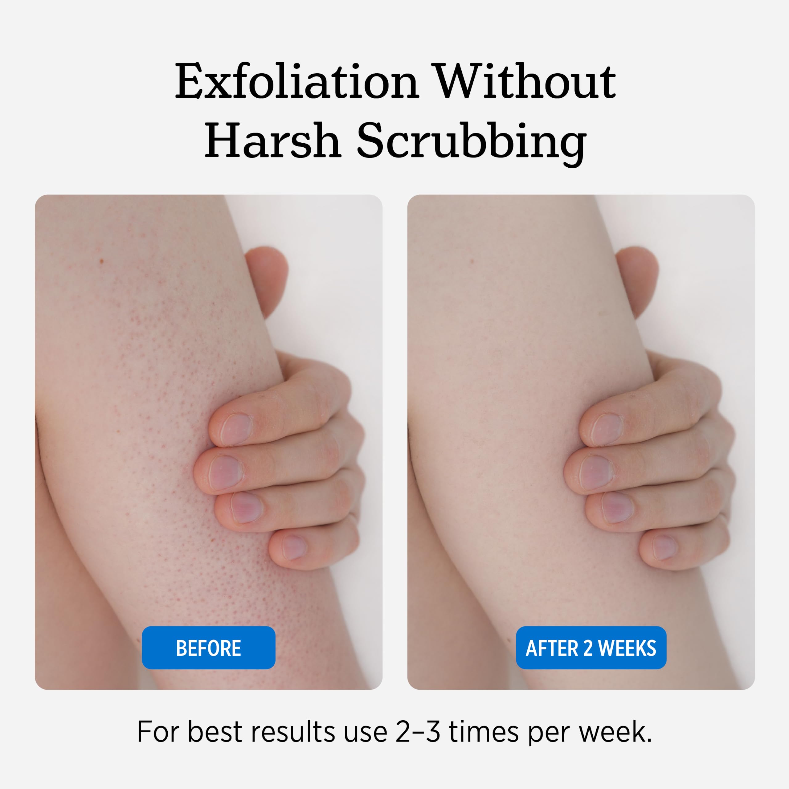 Nuvadermis KP Body Scrub - NUVADERMIS Official Imagery - 8