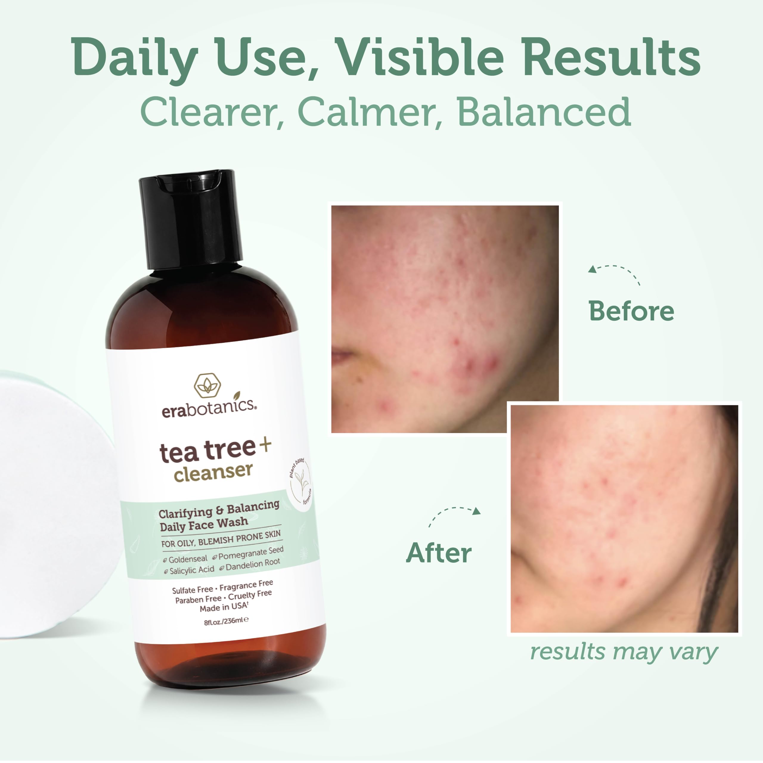 Era Organics Tea Tree Oil Face Wash - Era Organics Official Imagery - 5