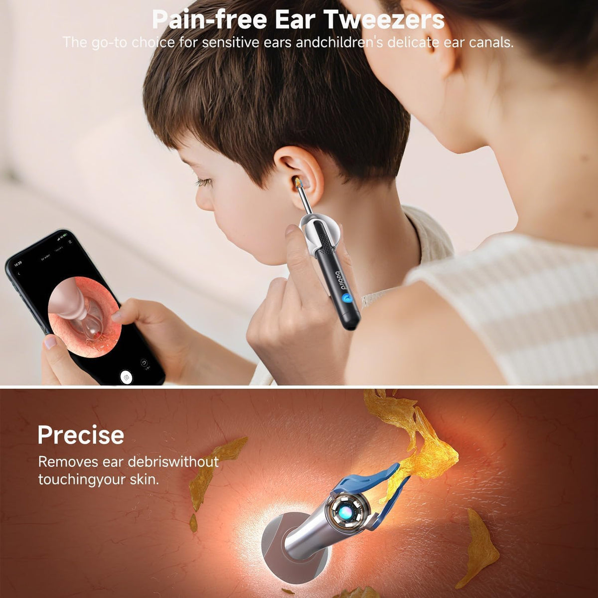 BEBIRD R1 Ultra Ear Wax Removal Tweezers 1296P HD Ear Camera - BEBIRD Official Imagery - 6