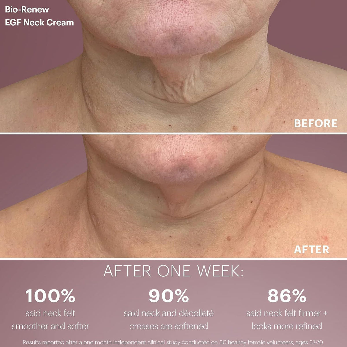 Glo Skin Beauty Bio Renew EGF Anti Aging Travel Discovery - Glo Skin Beauty Official Imagery - 6
