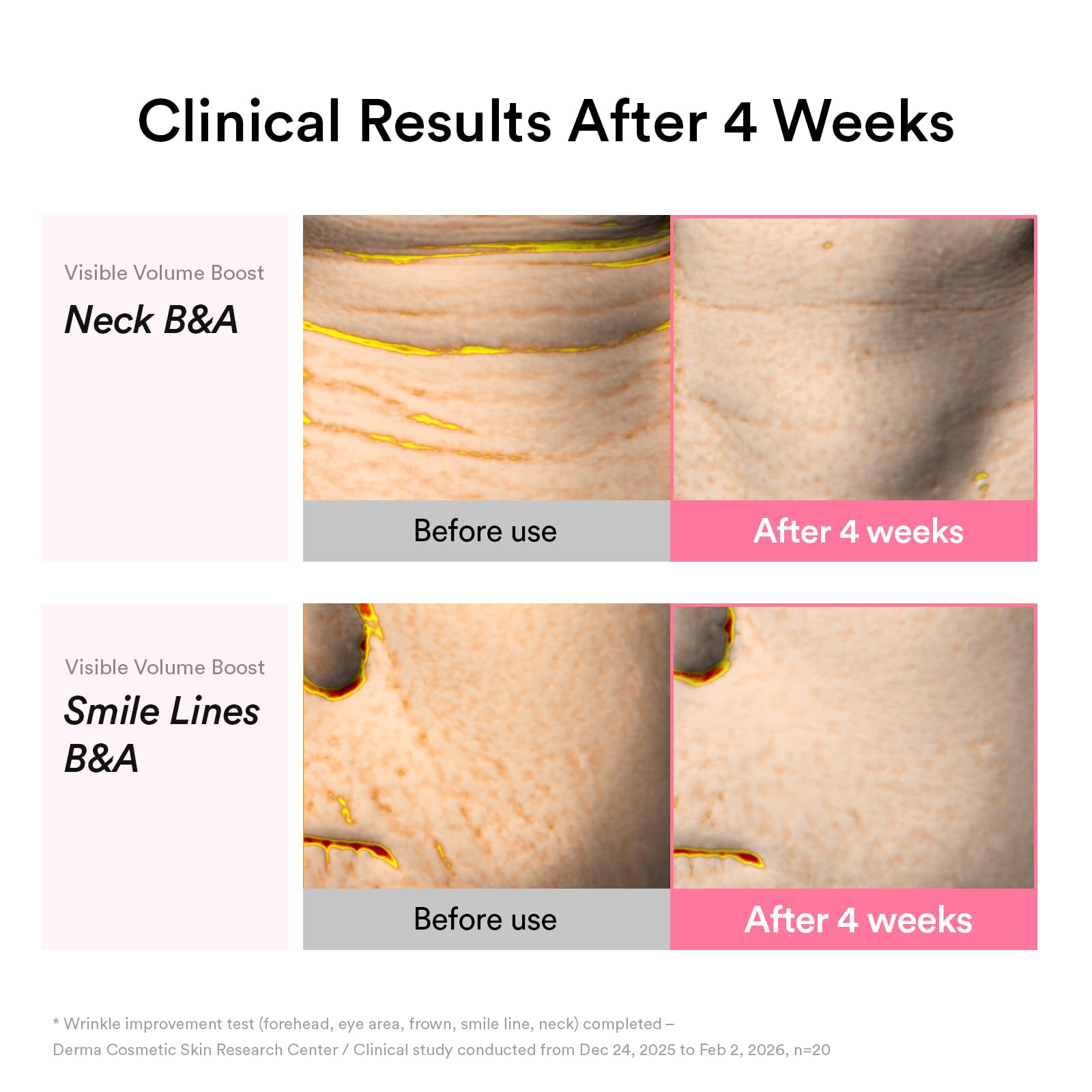 Abib PDRN Volume fill-it Booster Cream 2.5 tube - Abib