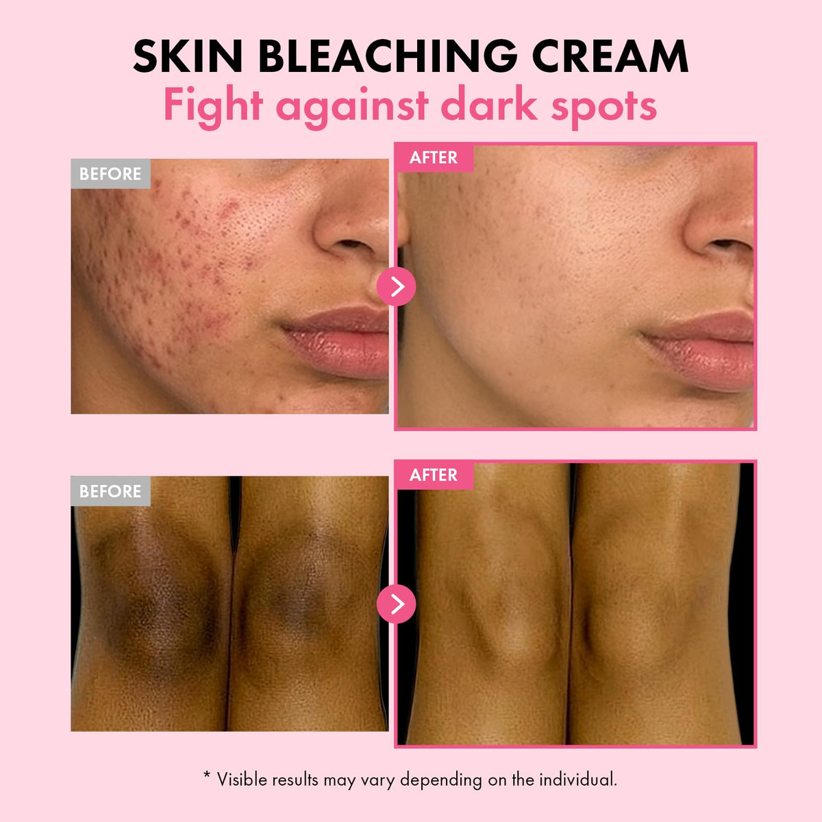 TOSOWOONG Dark Spot 35 Fade Cream for Dark Spots Uneven Tone - TOSOWOONG Official Imagery - 4