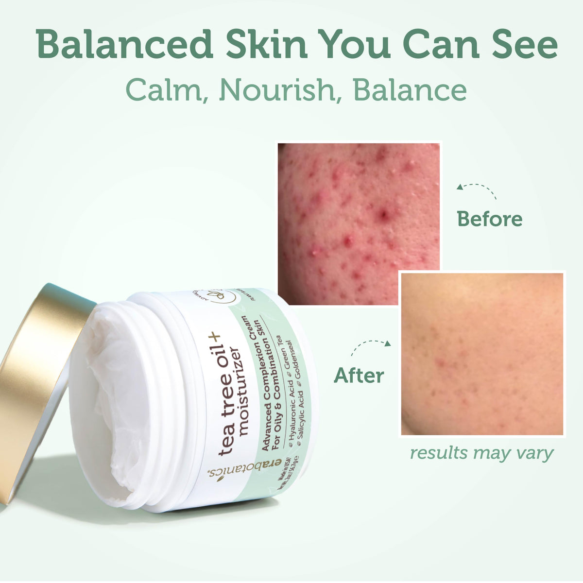 Era Organics Tea Tree Oil Face Cream - Era Organics Official Imagery - 5