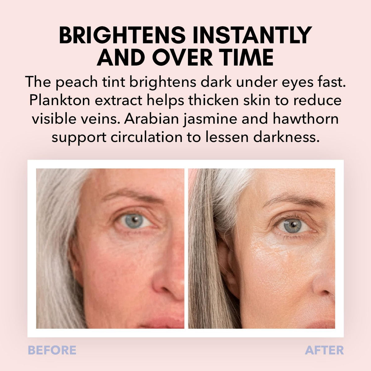 Clover Triple Shot 3 in 1 Bioactive Eye Treatment - Clover Official Imagery - 6