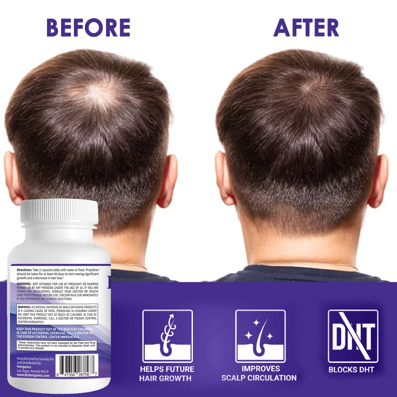 Propidren DHT Blocker Hair Growth Pills To Stop Hair Loss - Pronexa Official Imagery - 8