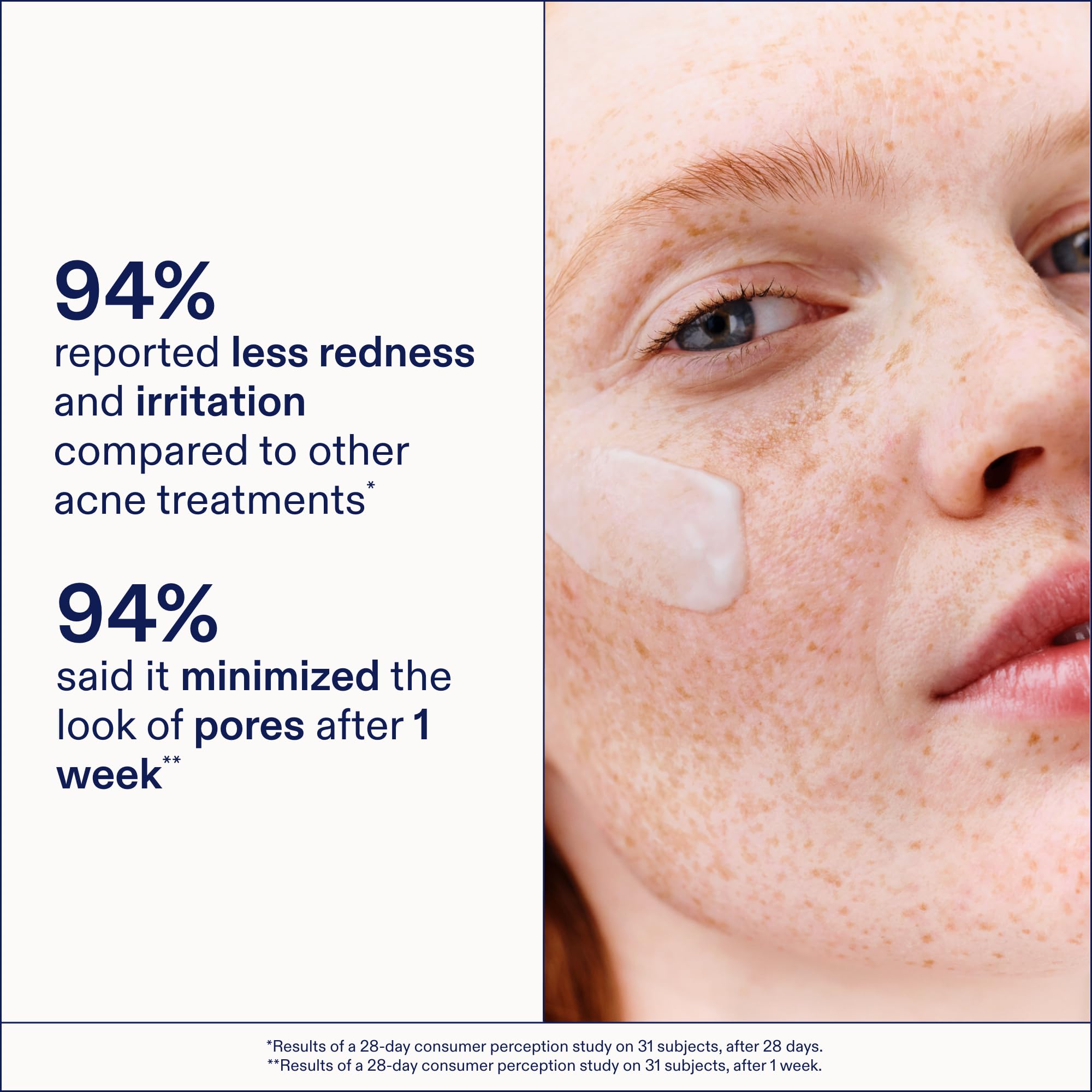 Skinfix Adapinoid Gel - Skinfix Official Imagery - 6