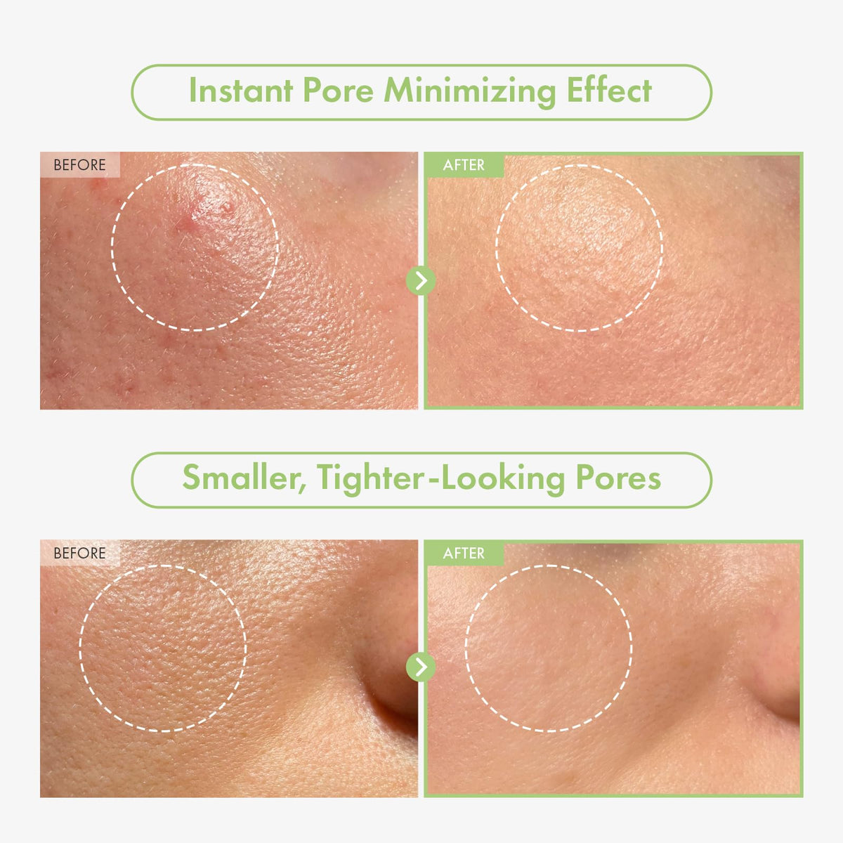 TOSOWOONG Green Caviar Pore Ampoule for Pore Care Firming - TOSOWOONG Official Imagery - 4