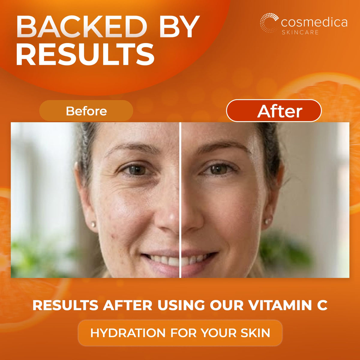 Cosmedica Skincare Vitamin C Serum for Face with Hyaluronic - Cosmedica Skincare Official Imagery - 6