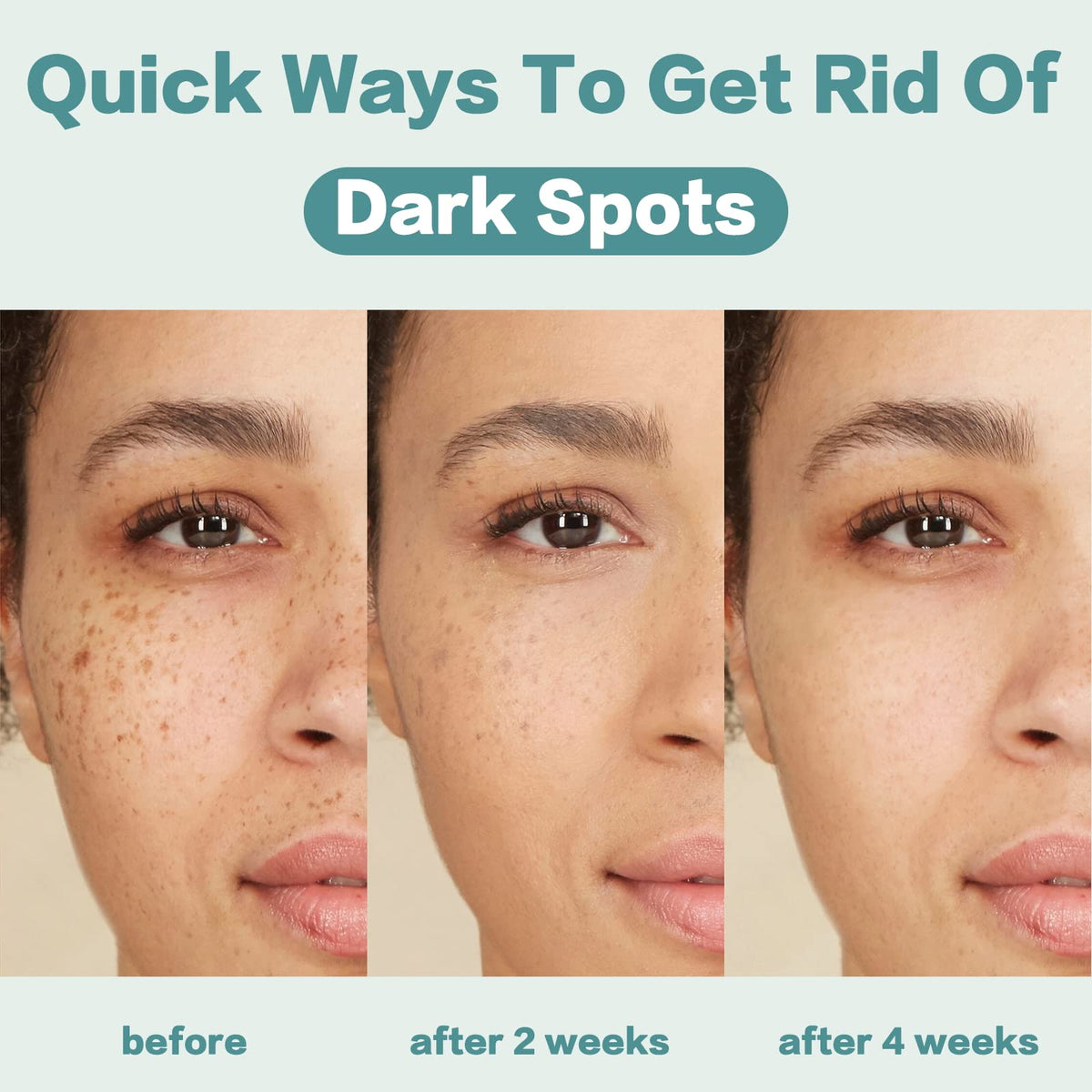 Dark Spot Remover for Face Dark Spot Corrector Cream - CITYGOO Official Imagery - 4