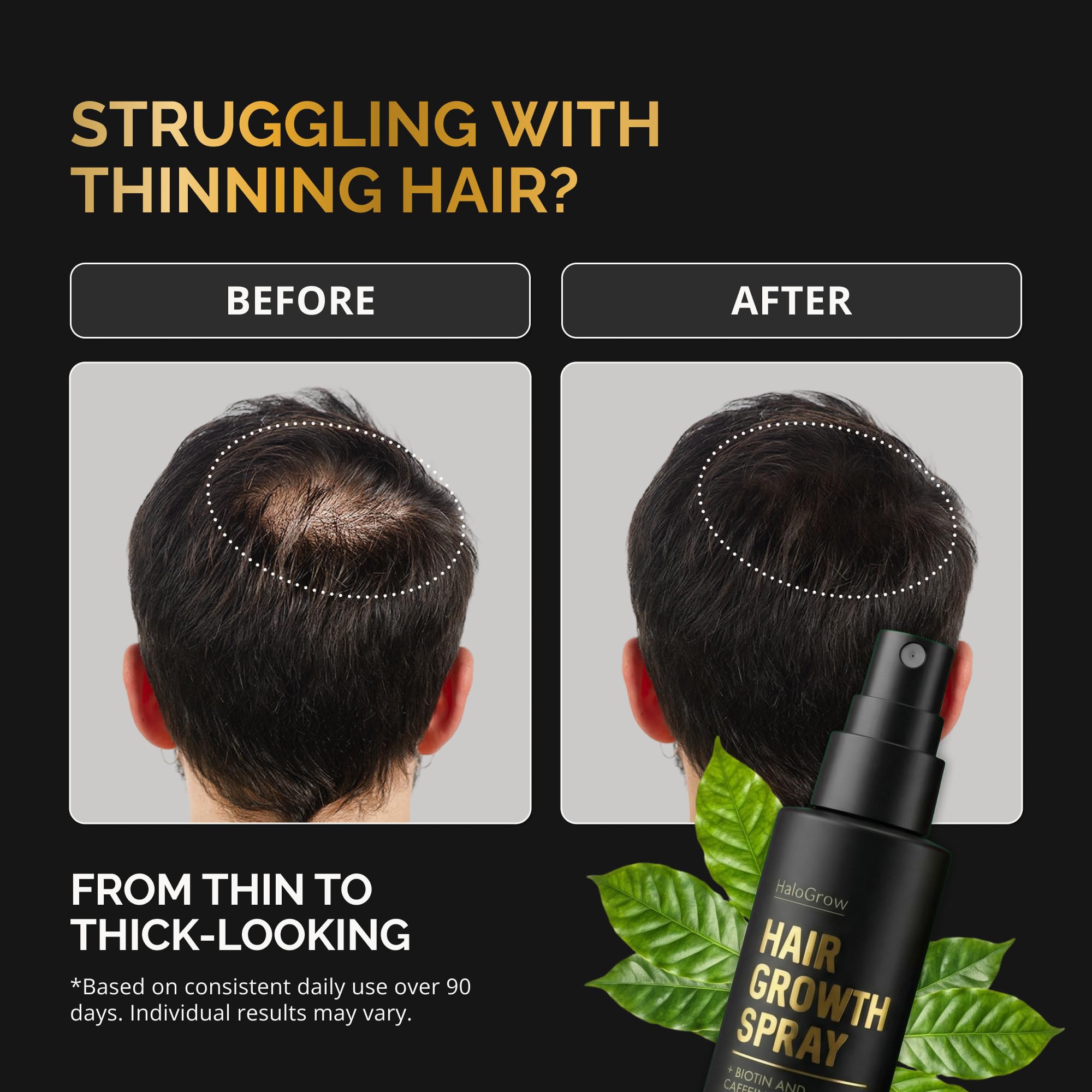 HALOGROW Hair Growth Serum Spray & Men Hair Loss – Biotin & Caffeine, Anti - - HALOGROW Official Product View 3