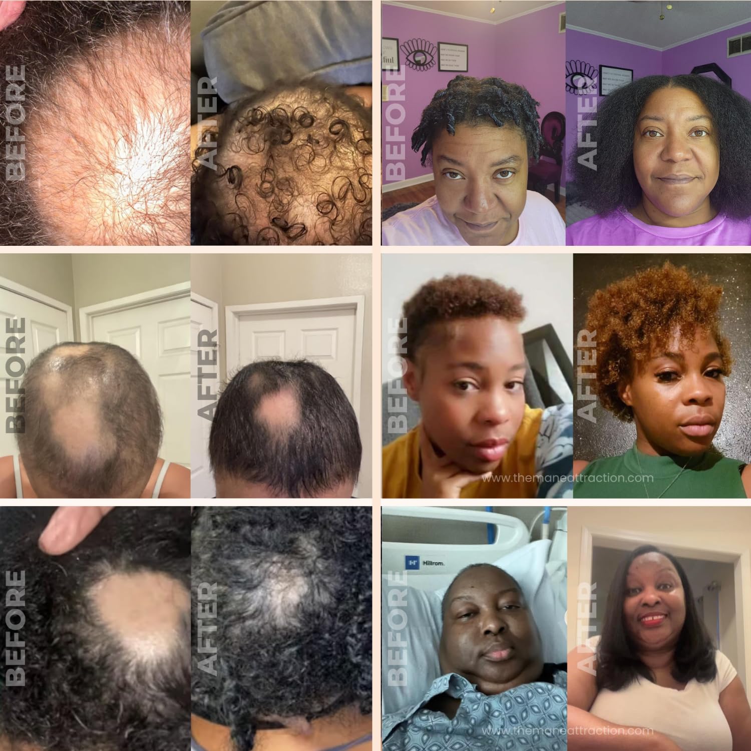 The Mane Attraction Extra - Strength Herbal Hair Growth Oil & 4 Fl - The Mane Attraction Official Product View 6