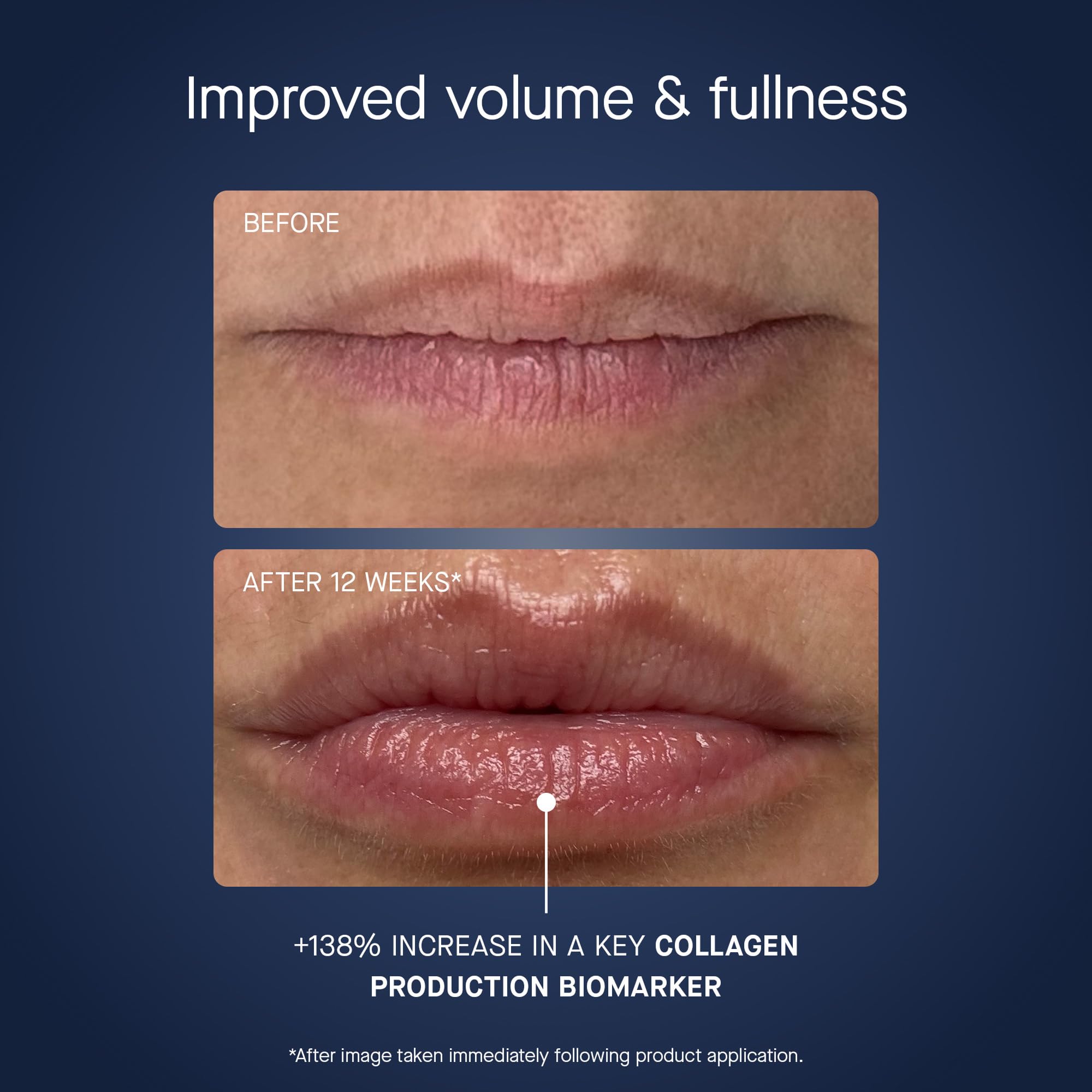 oneskin OS 01 Peptide Lip Mask Smoother Fuller Lips Plumping - Premium Selection Official Imagery - 7