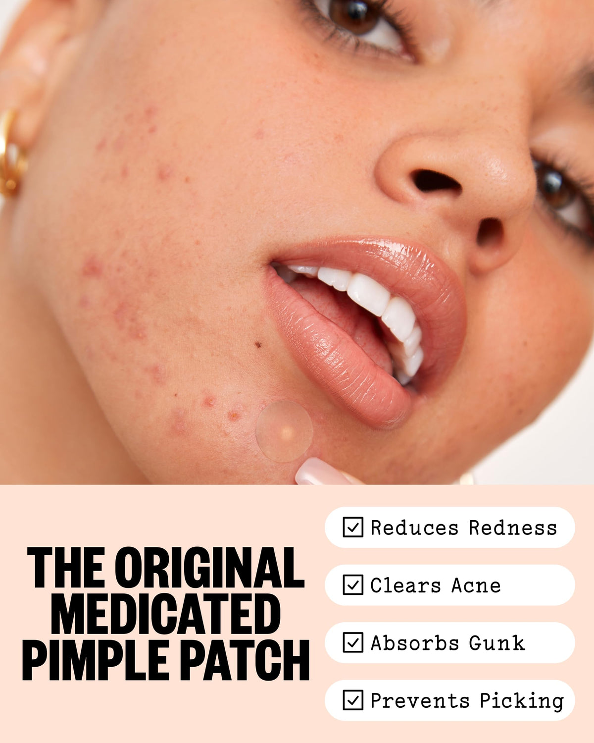 PEACE OUT Acne Day Night Duo Hydrocolloid Pimple Patches - PEACE OUT Official Imagery - 3