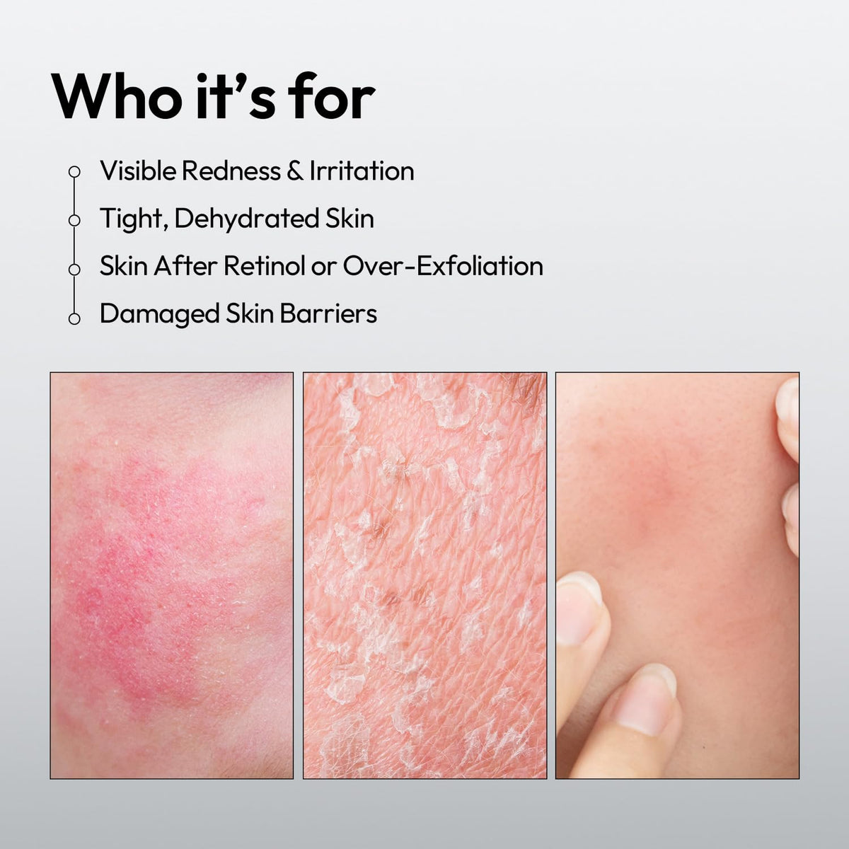 LAYERLAB Barrier Boost Serum Panthenol Niacinamide Face - LAYERLAB Official Imagery - 4