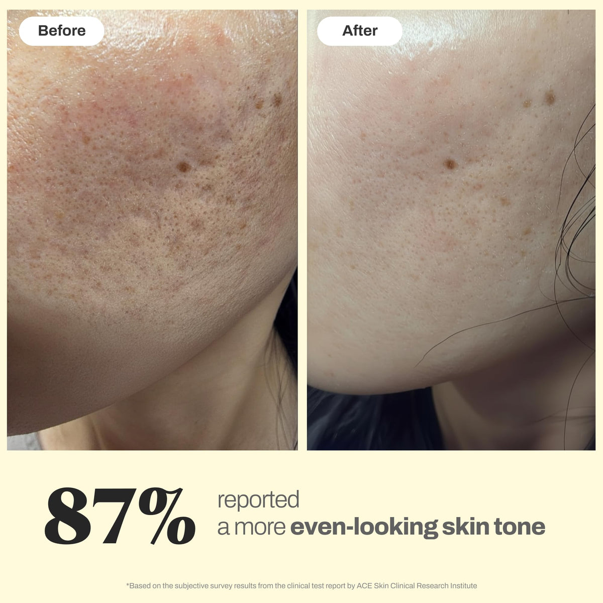 Brightening Glow Essence - Aeluri Formula Official Imagery - 8