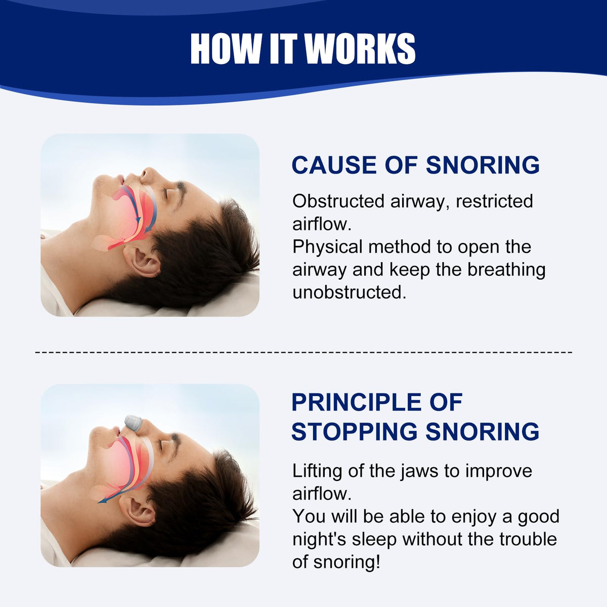 Anti Snoring Devices Snoring Solution Effective Snoring - EENET Official Imagery - 3