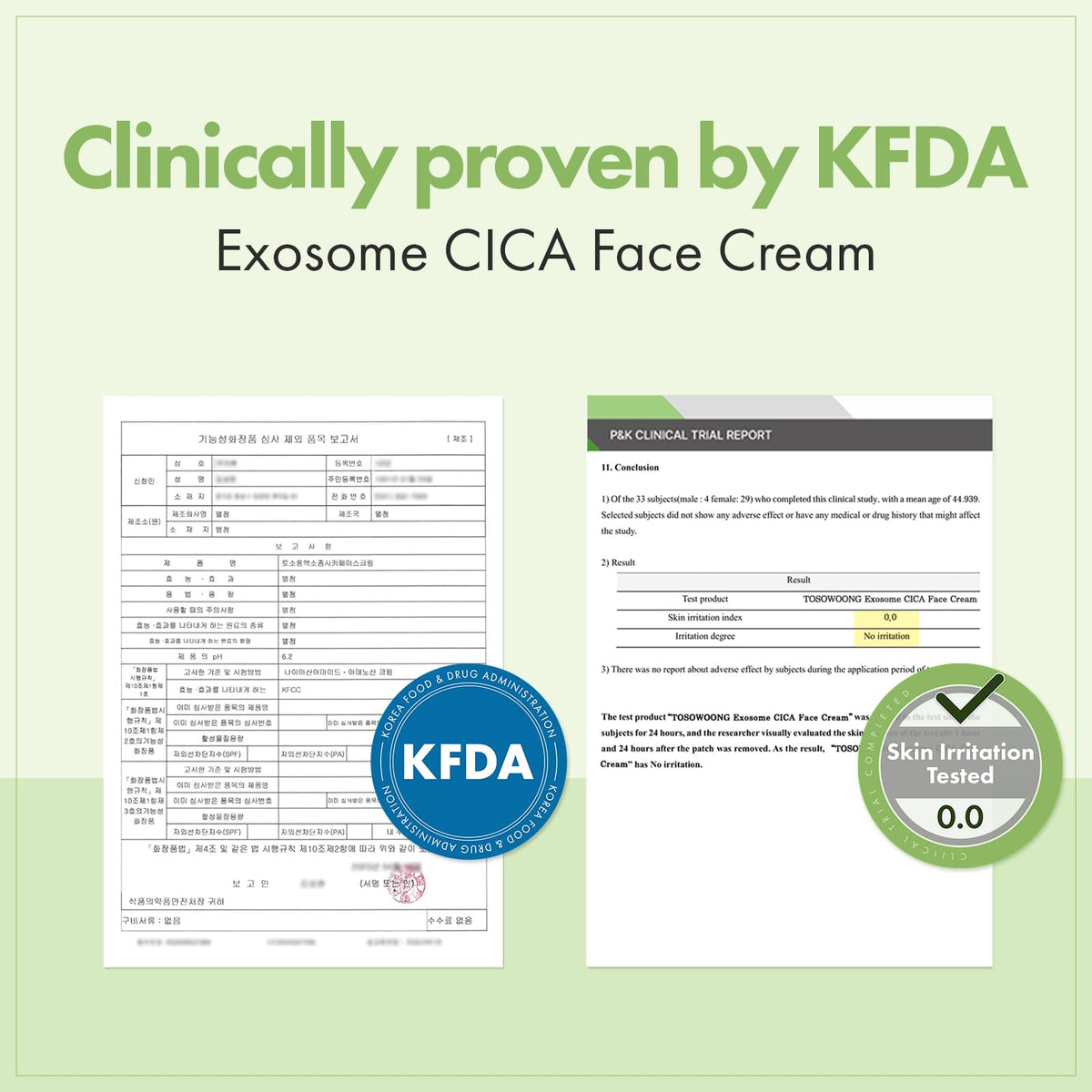 TOSOWOONG Exosome CICA Face Cream for Redness Blemish Prone - TOSOWOONG Official Imagery - 6