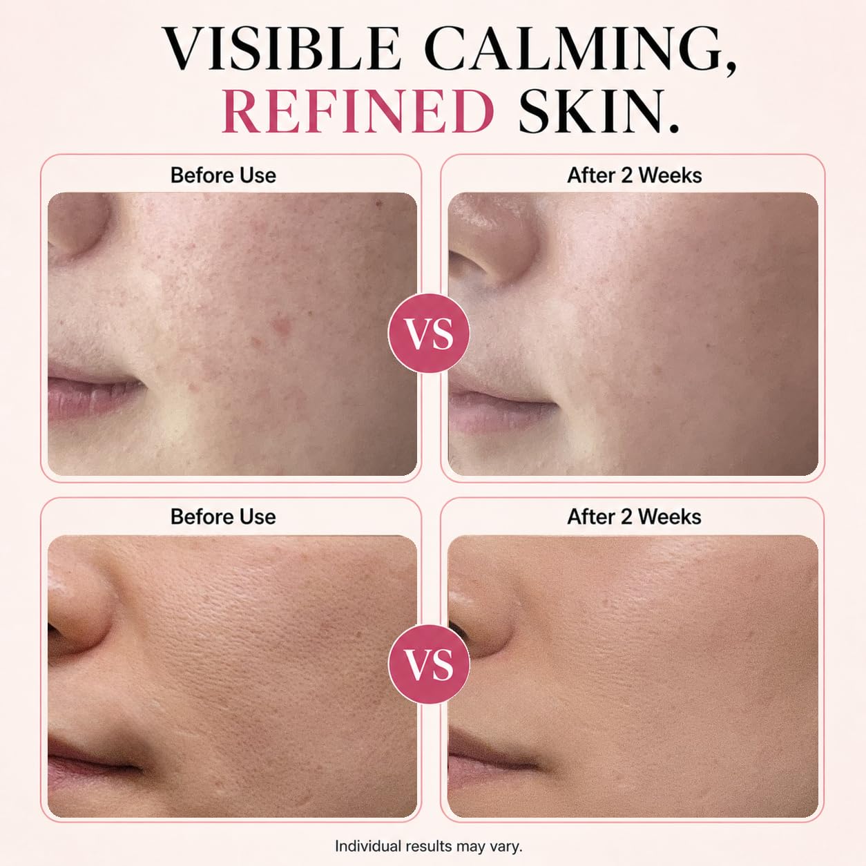 Korean Face Serum with Hyaluronic Acid Niacinamide 30 ml - CHALTTOK Official Imagery - 5