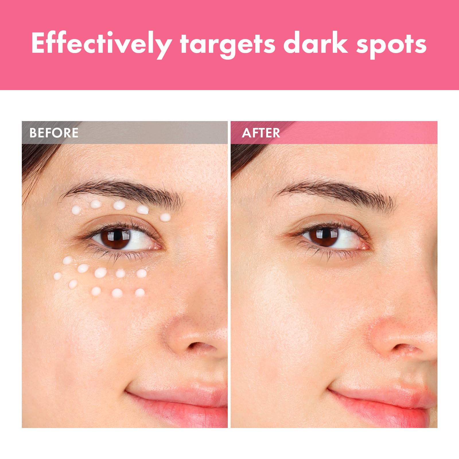 TOSOWOONG Arbutin 7 Intensive Spot Cream for Dark Spots - TOSOWOONG Official Product Imagery - 4