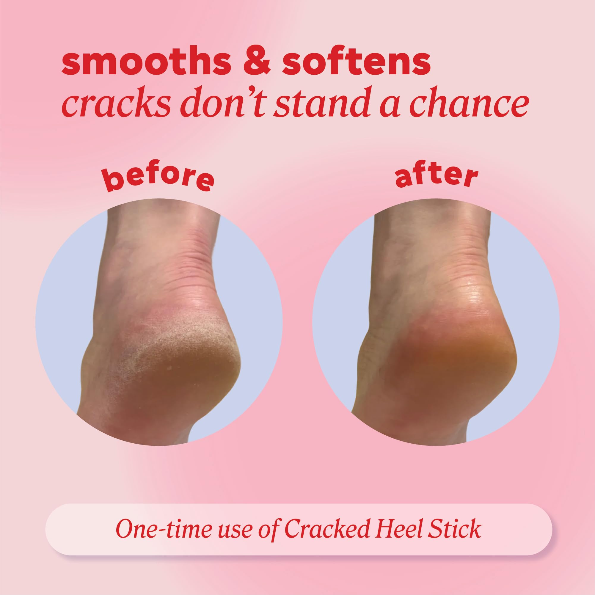 Onyx Professional Heel Repair Balm Stick in coconut scent, a skin moisturizer for softening and repairing dry, cracked heels.