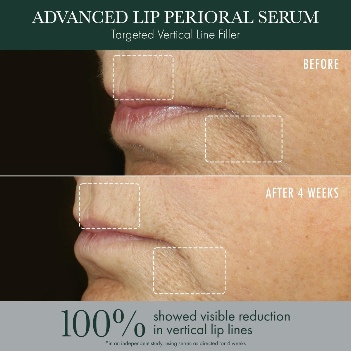 R Vive Advanced Perioral Lip Serum - RéVive Official Imagery - 6