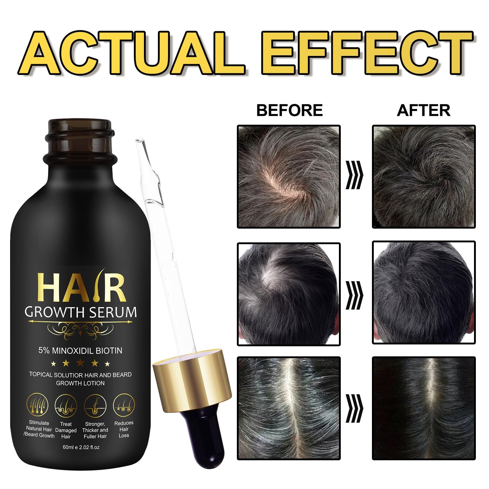 SOLEMEONY 5% Minoxidil Hair Growth Serum - for Stronger Thicker Longer & Hair Reg - SOLEMEONY Official Product View 3