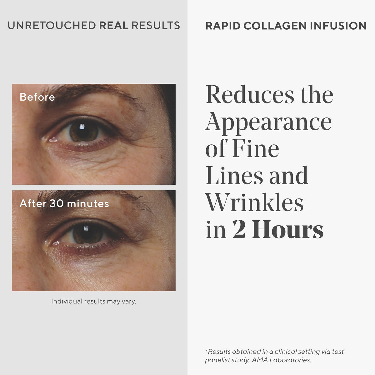 Murad Rapid Collagen Infusion - Murad Official Imagery - 4
