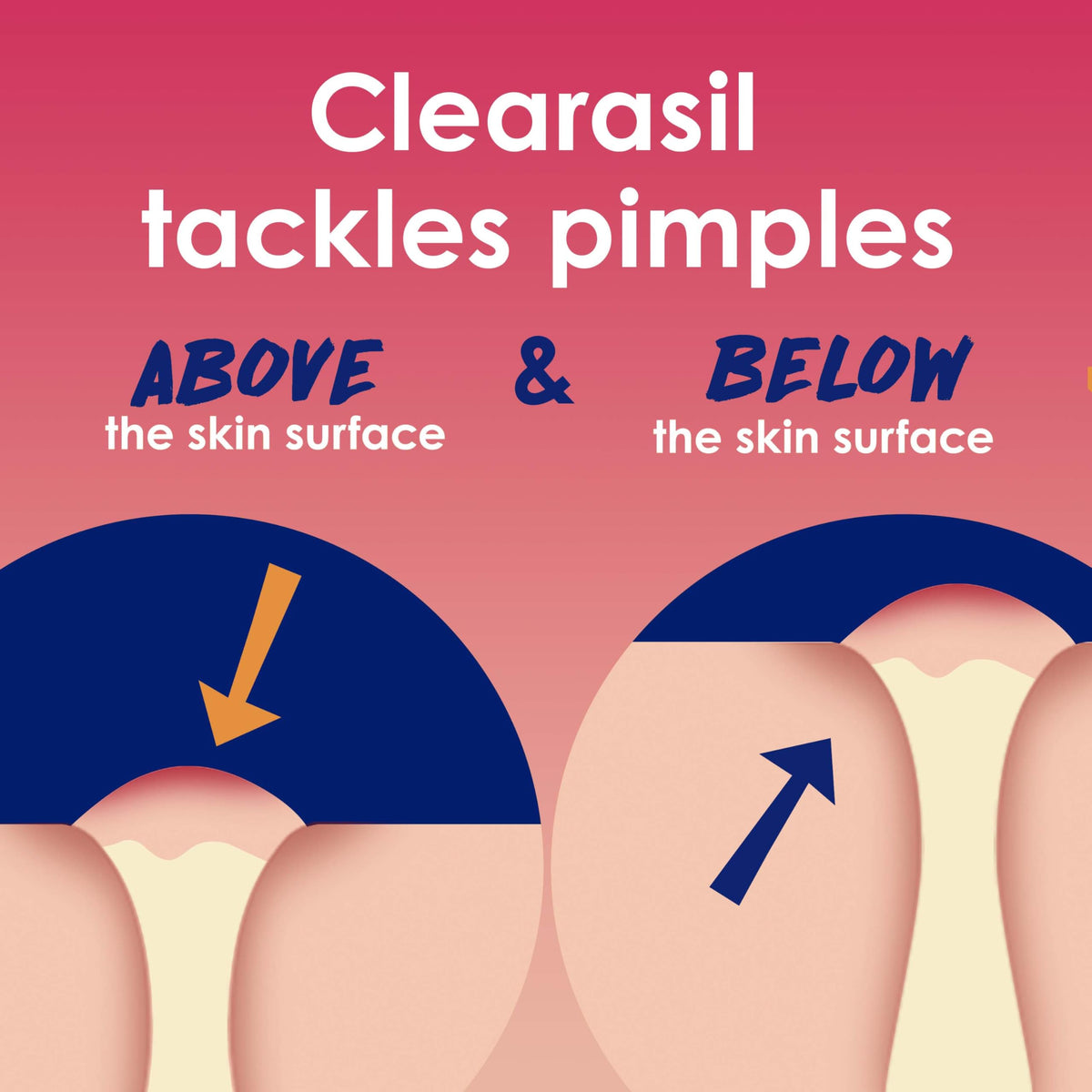 Clearasil Rapid Rescue Deep Treatment Acne Face Pads Maximum - Clearasil Official Imagery - 4