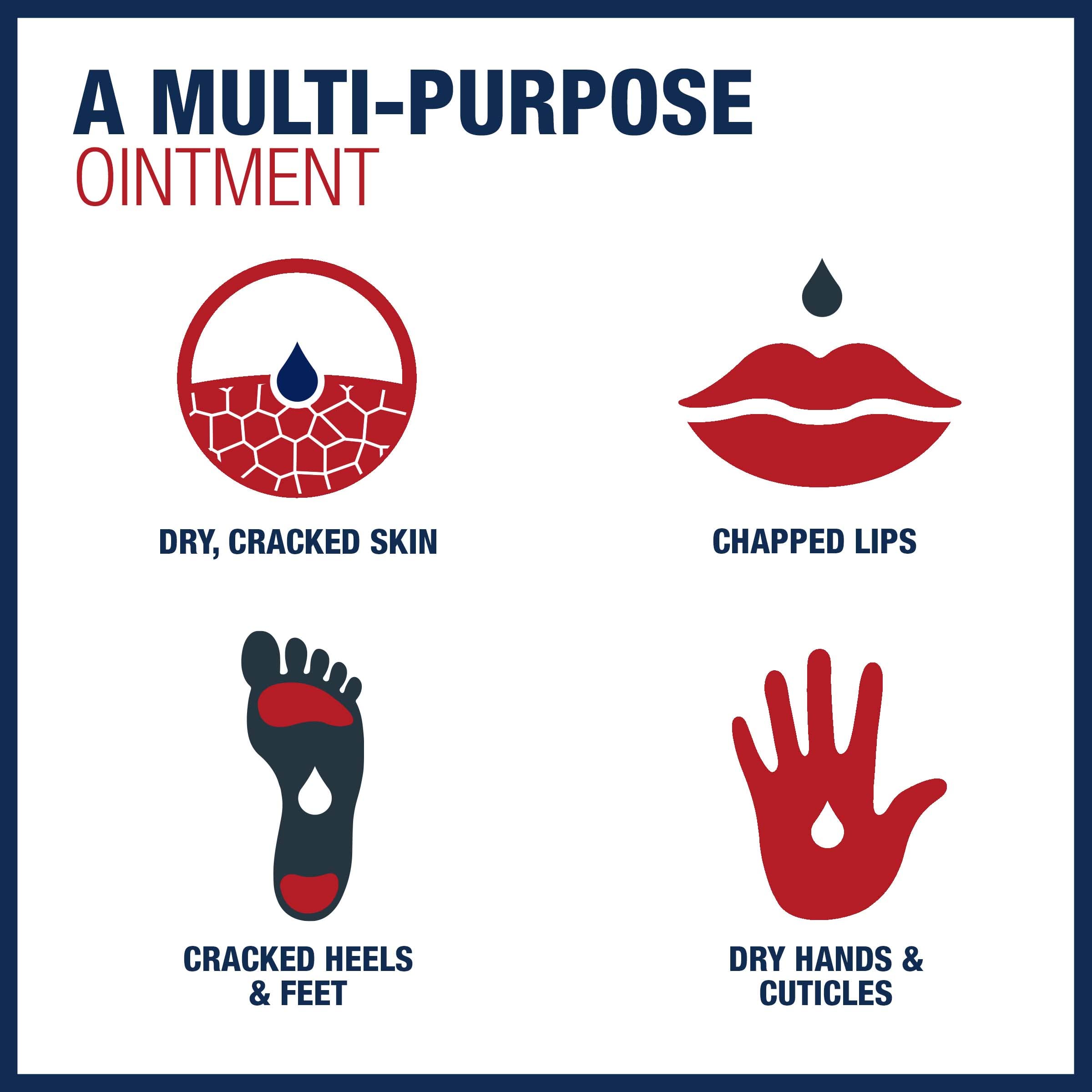Aquaphor Advanced Therapy Healing Ointment, Skin Protectant, 7 OZ - Aquaphor Official Product View 10