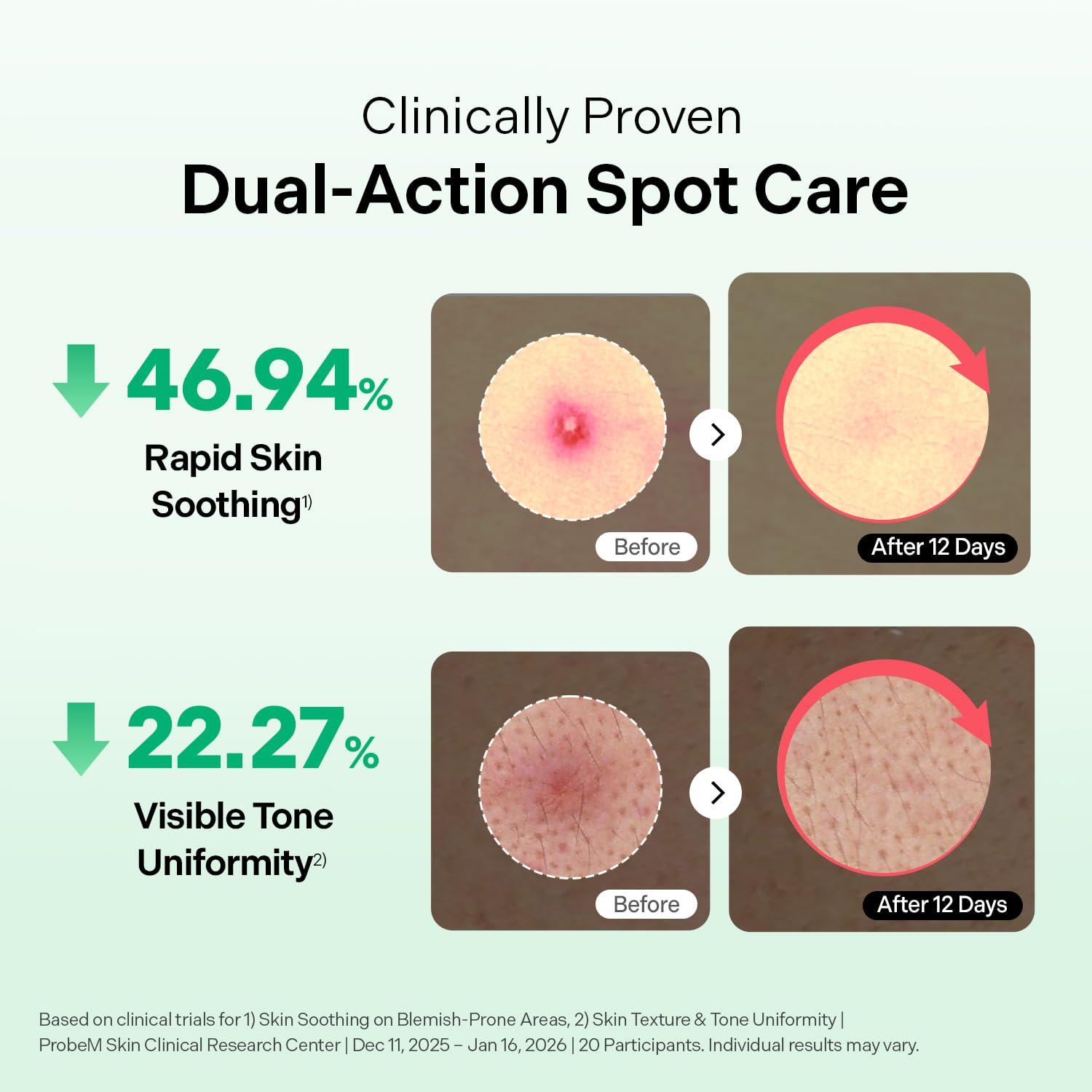 Torriden BALANCEFUL Azelaic Acid Micropoint Spot Patch (12 - Torriden