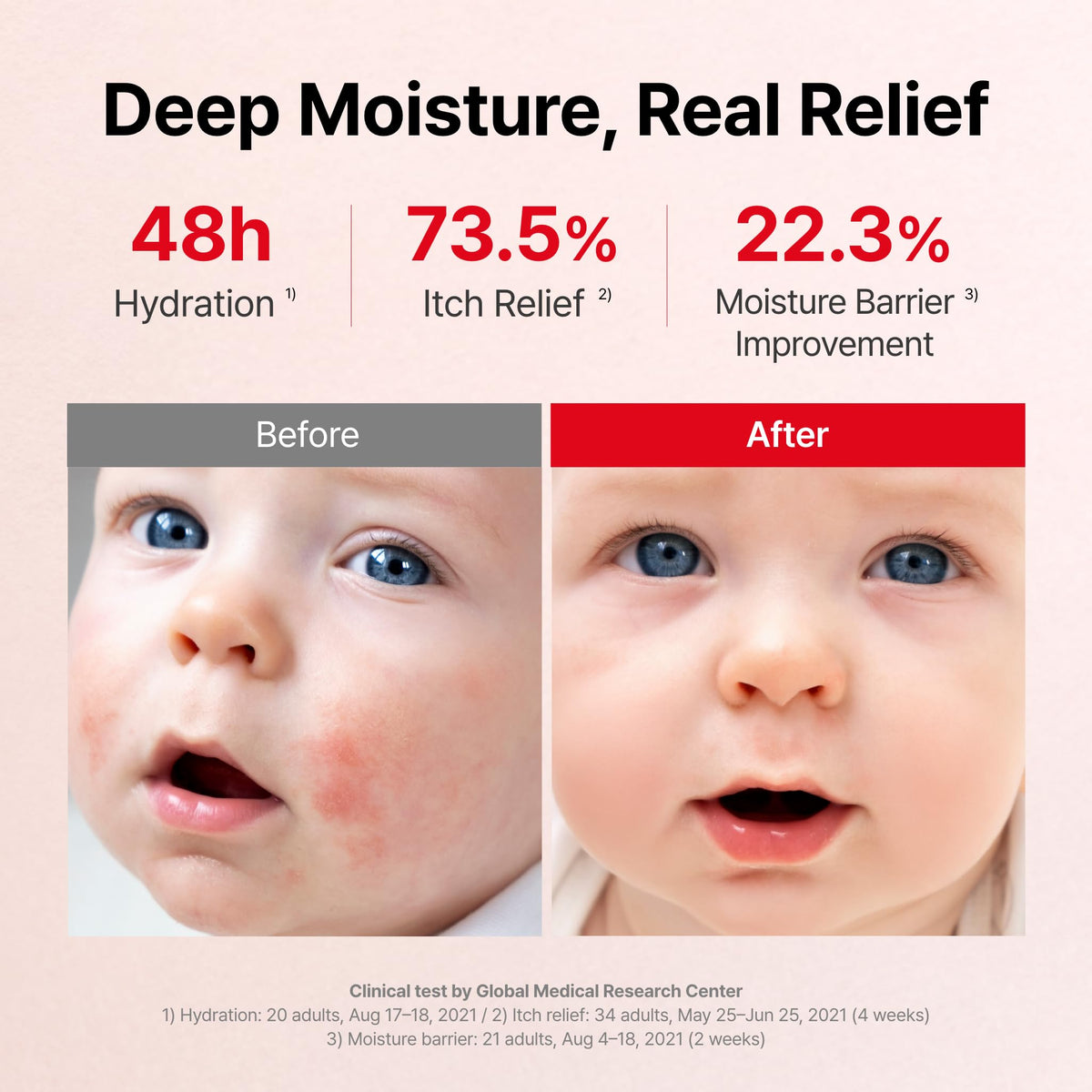 ATOPALM MLE Eczema Cream 5 6 fl oz - ATOPALM Official Imagery - 5