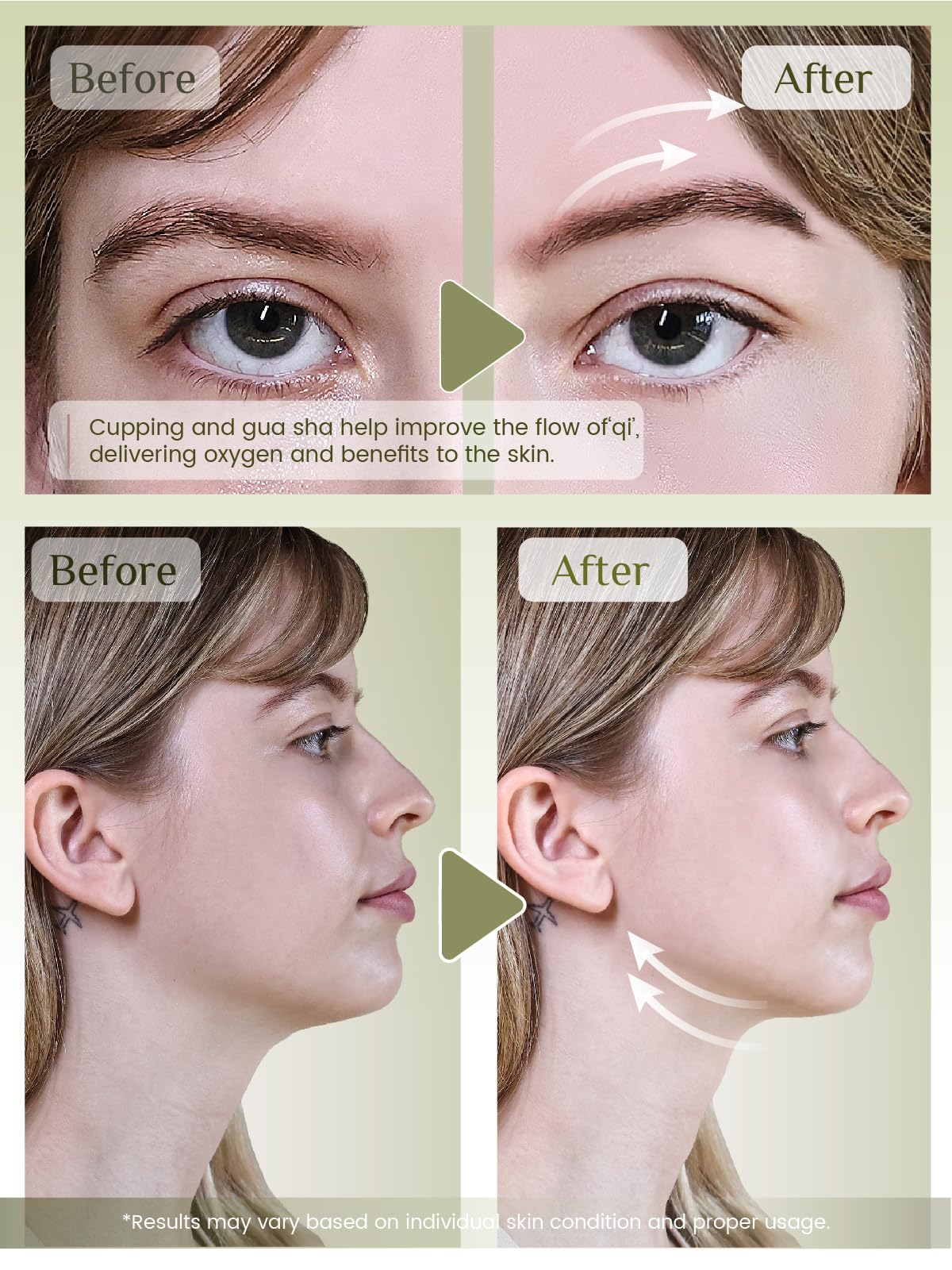 Rena Chris Facial Cupping Set Gua Sha Tool - Rena Chris Official Product Imagery - 4