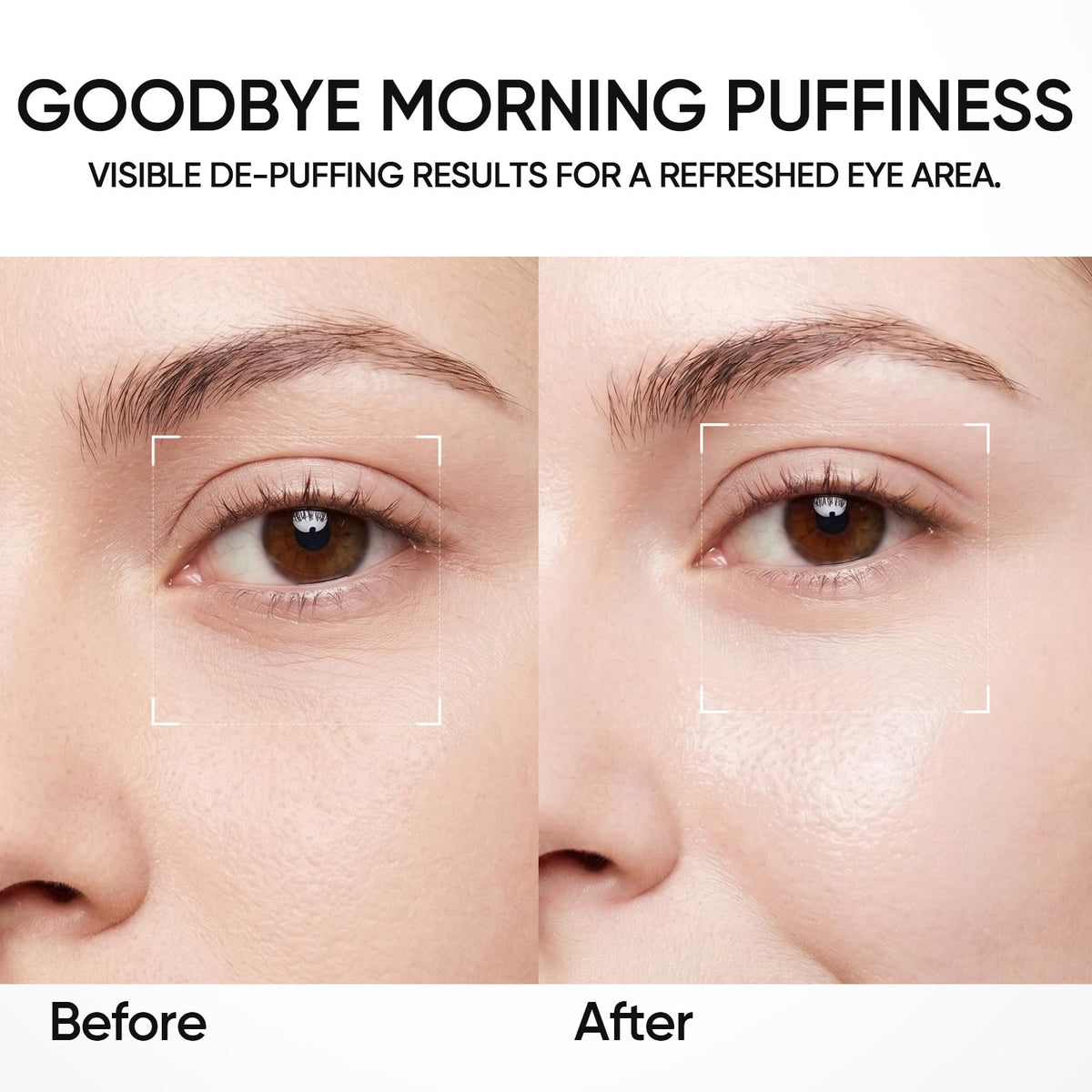 SKINTIFIC Lifting Eye Cream Reduce Puffiness fine lines Dark - SKINTIFIC Official Imagery - 5