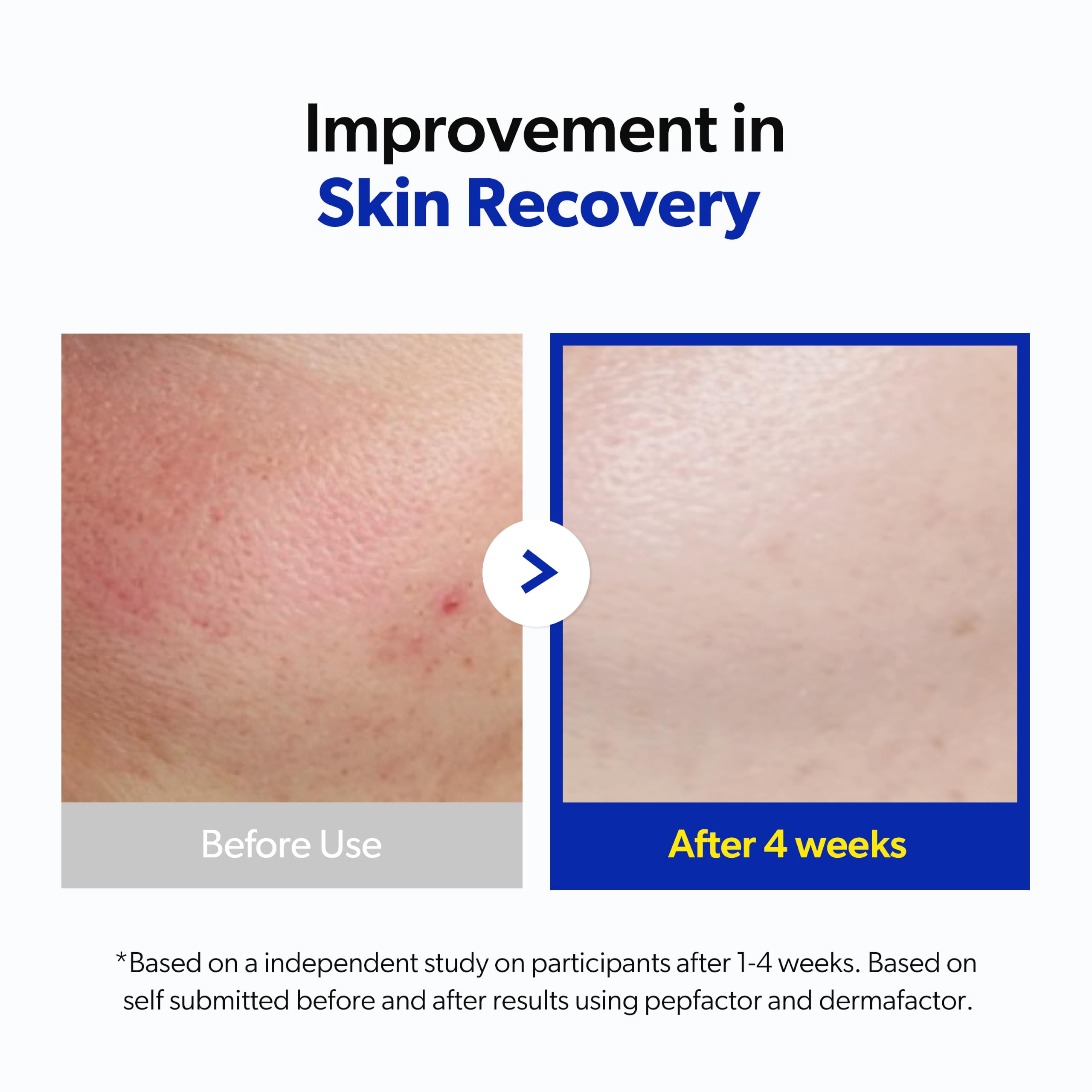 Pepfactor 23% Growth Factor Barrier Recovery Serum - bnv biolab