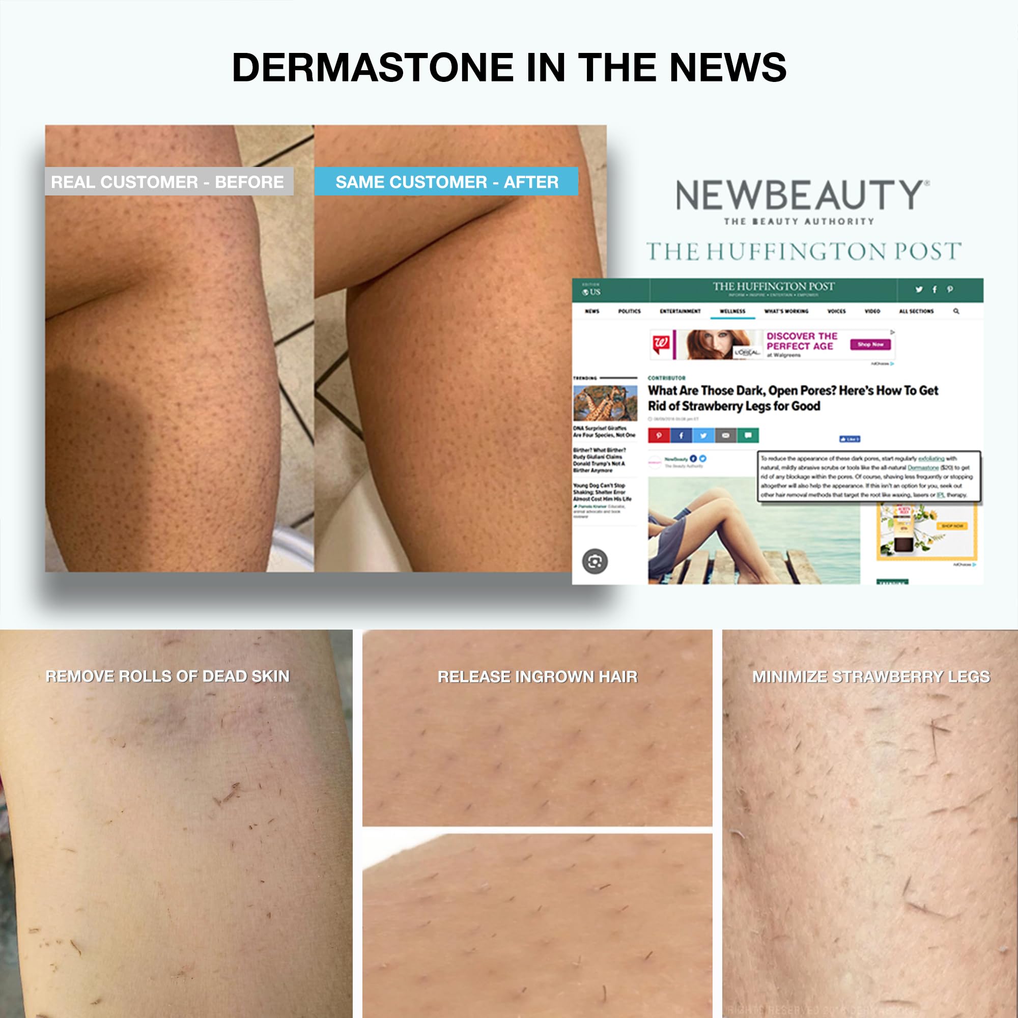 Dermastone LEG & BODY SCRUB - Deep Exfoliating Stone Body Scrubber f - Dermastone Official Product View 8