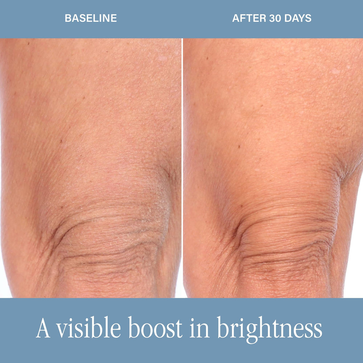 SKINN DermAppeal Exfoliating Body Scrub - SKINN Official Imagery - 6