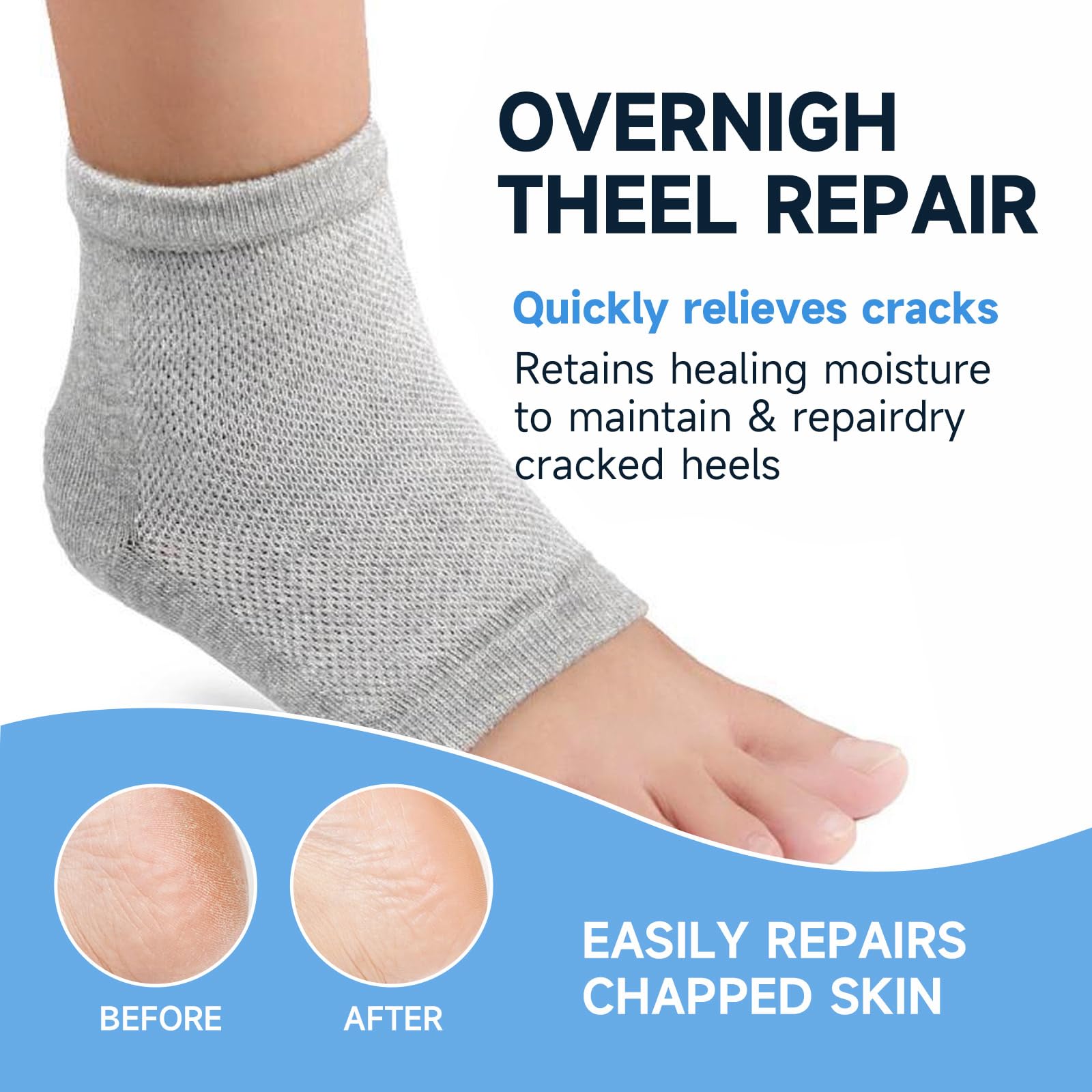 PasaRose Heel Crack Care & Moisturizing Set, Includes a pair of moisturizing heel socks and a professional heel repair stick. deeply treats dry and cracked feet