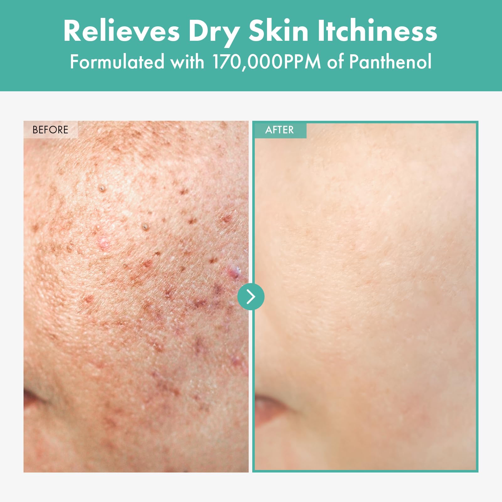 TOSOWOONG Dexpanthenol 17 Cream B5 for Barrier Hydrating - TOSOWOONG Official Imagery - 3
