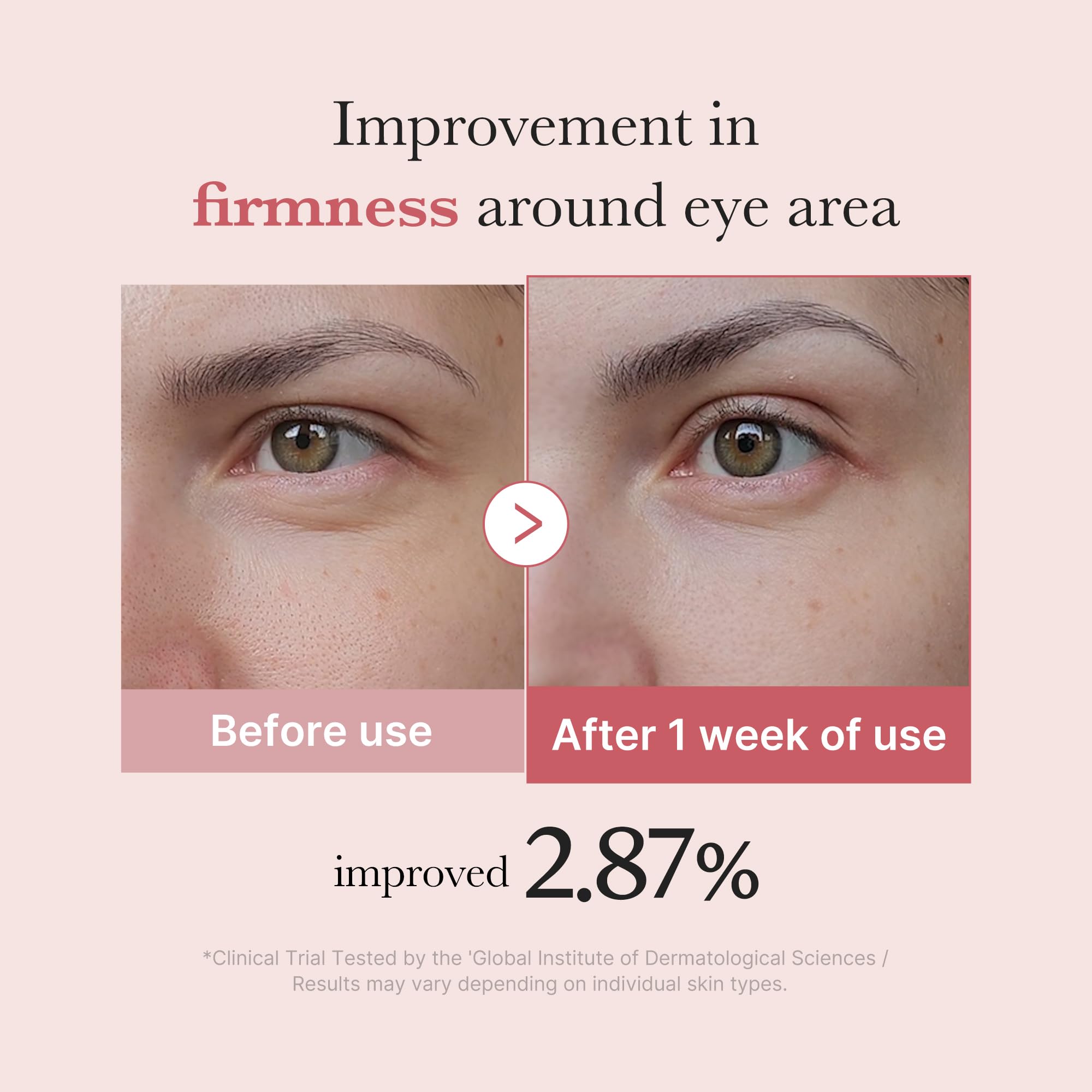 medicube Eye Serum with Salmon DNA PDRN Pink Peptides - medicube Official Product Imagery - 5