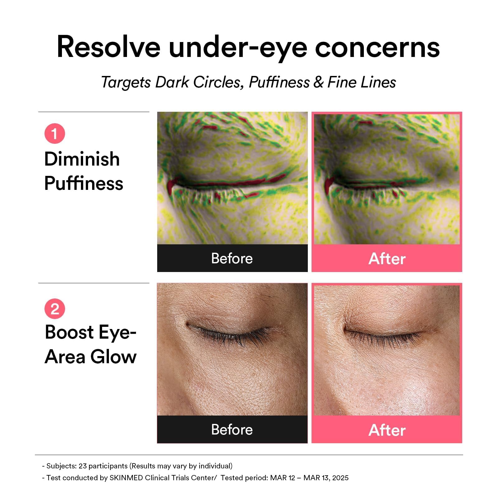 Abib PDRN Retinal Eye Patches for Rejuvenating & Puffy Eyes with Glow Jelly, Niacinamide, 60 Count, Korean Skin Care - Abib Official Product View 6