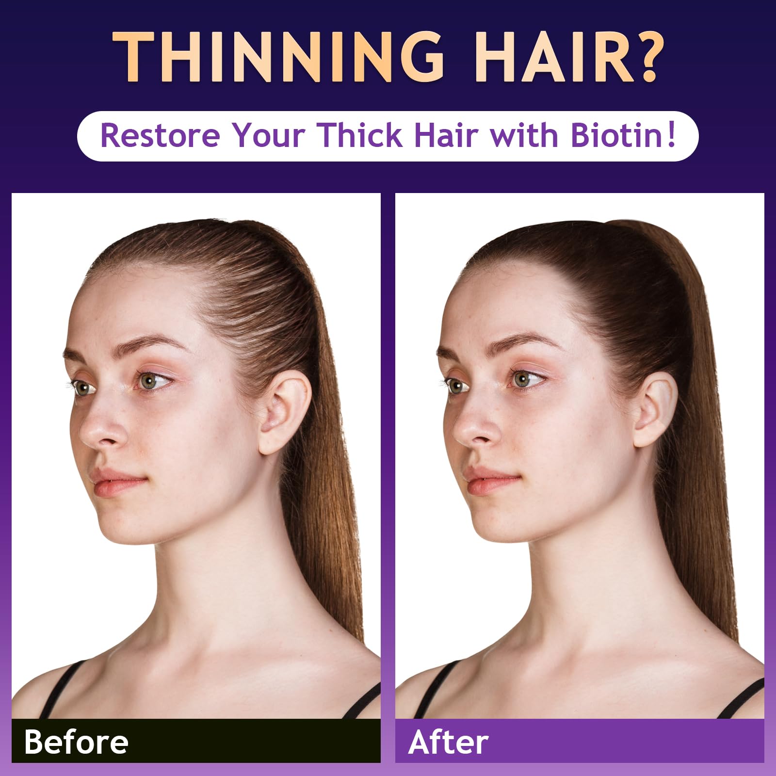 Biotin Hair Growth Shampoo Hair Loss Shampoo for Thinning - oely Official Imagery - 3