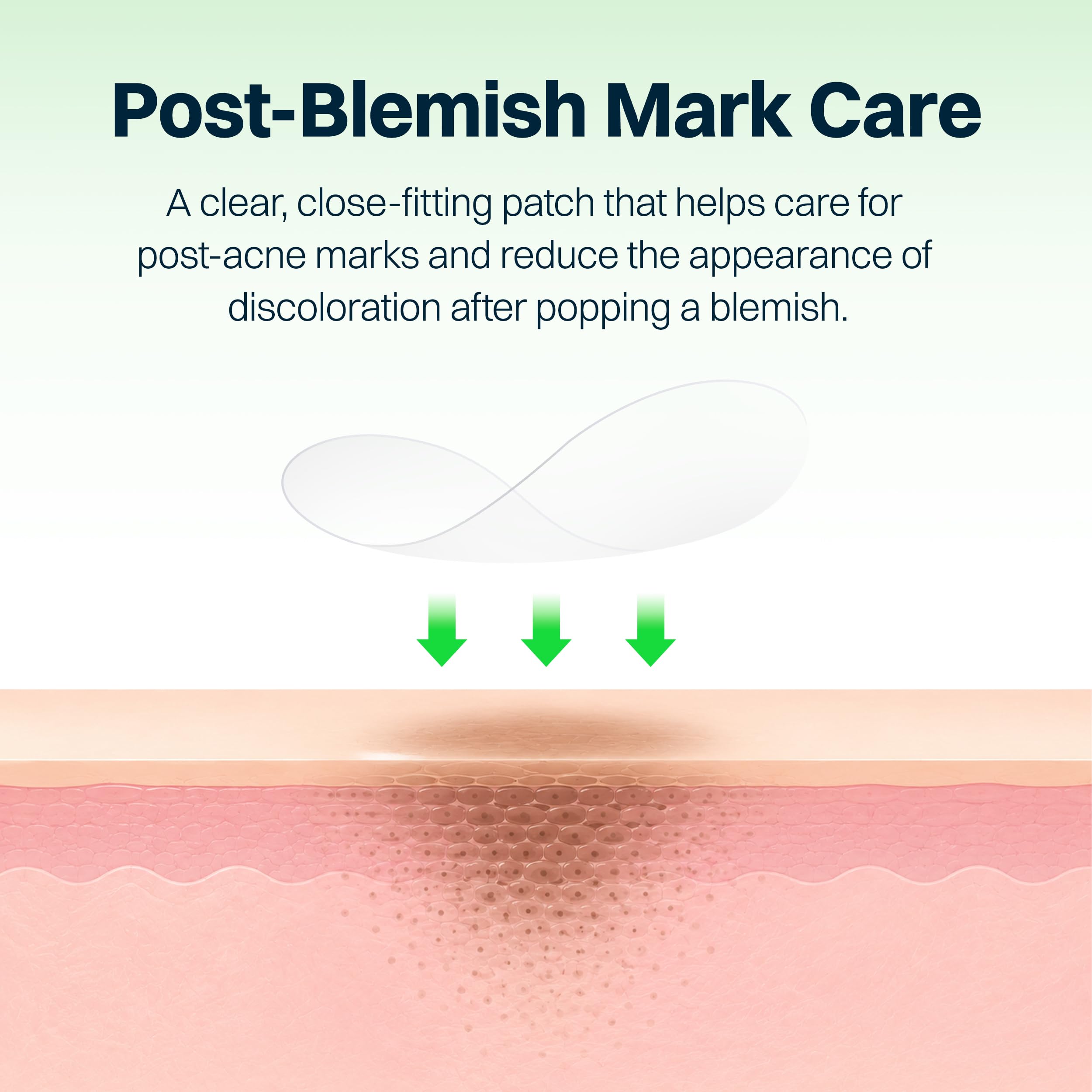 FRANZ Invisible Post Acne Mark Patches Tone Care Dots - FRANZ Official Product Imagery - 5