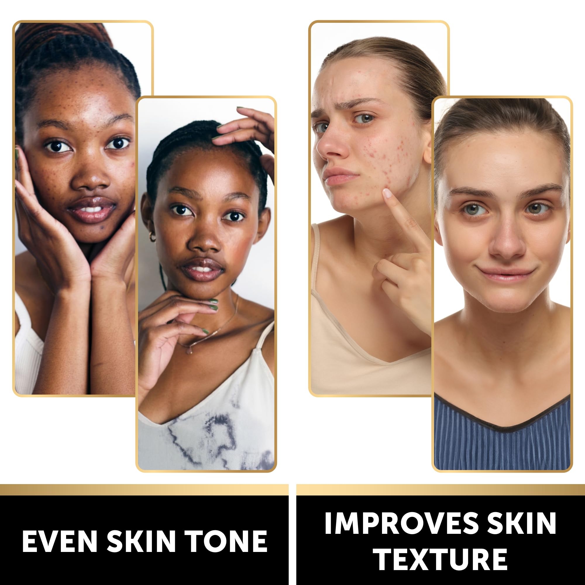 VALITIC Snail Mucin Kojic Acid Soap Bar Anti Aging Tone - VALITIC Official Imagery - 4