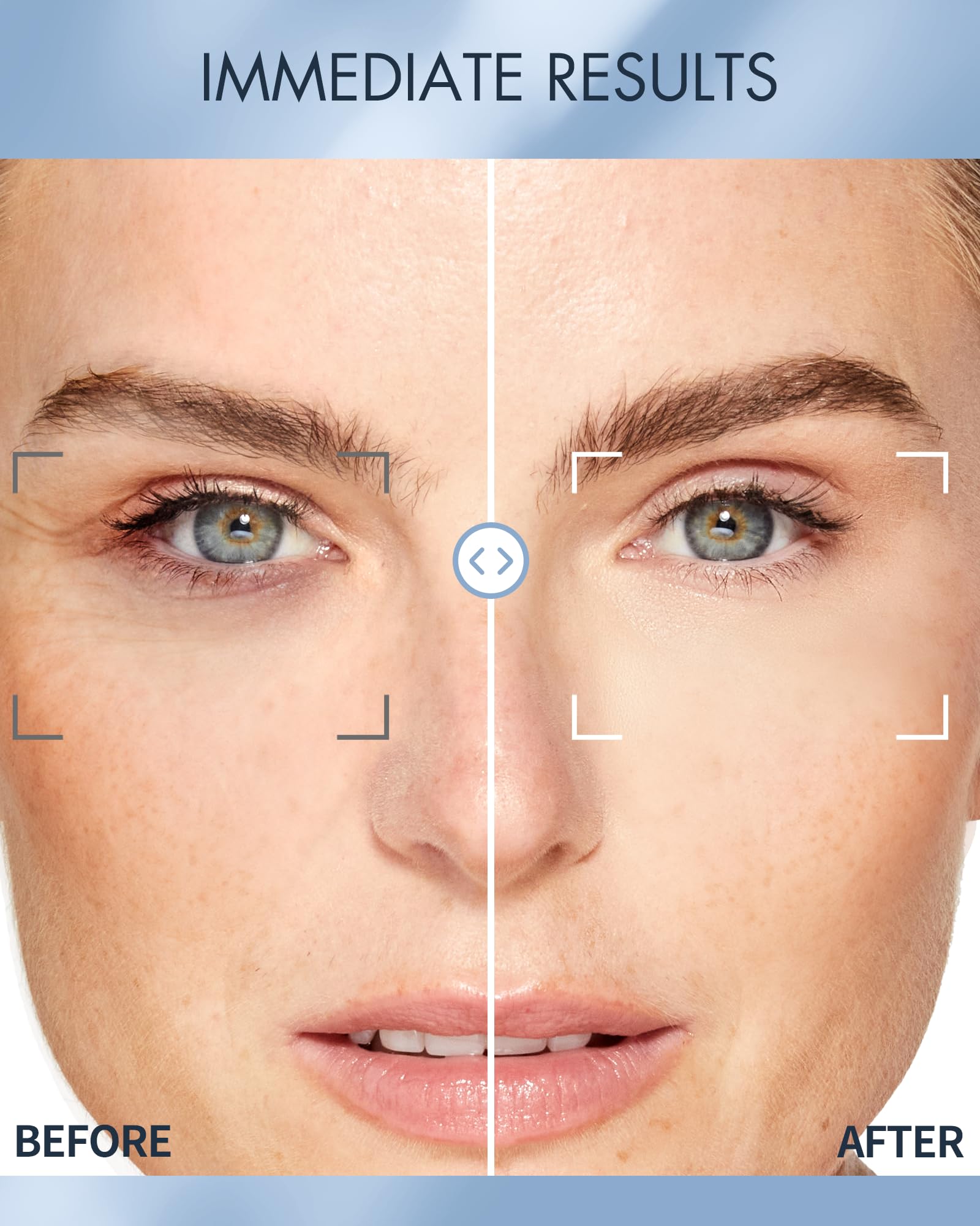 depology Replenish Repair Under Eye Patches for Puffy Eyes - depology Official Imagery - 5